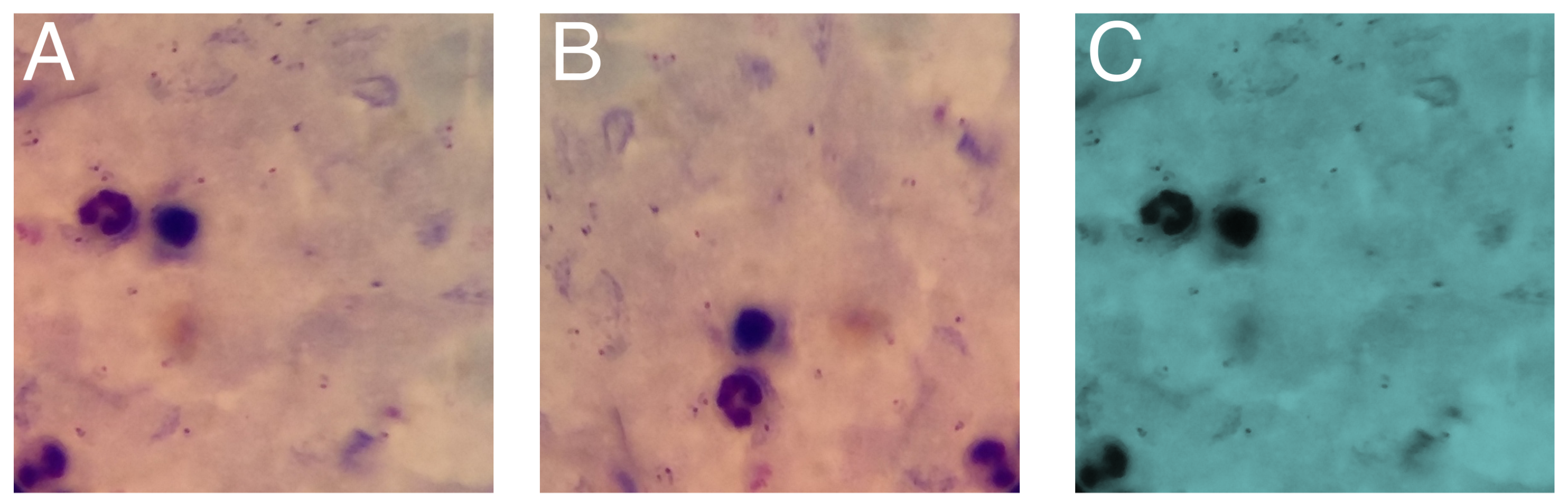 Diagnostics 14 00690 g004