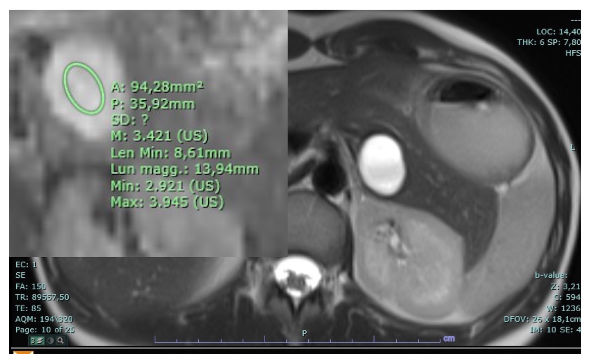 Diagnostics 14 00693 g019 Diagnostics 14 00693 g019