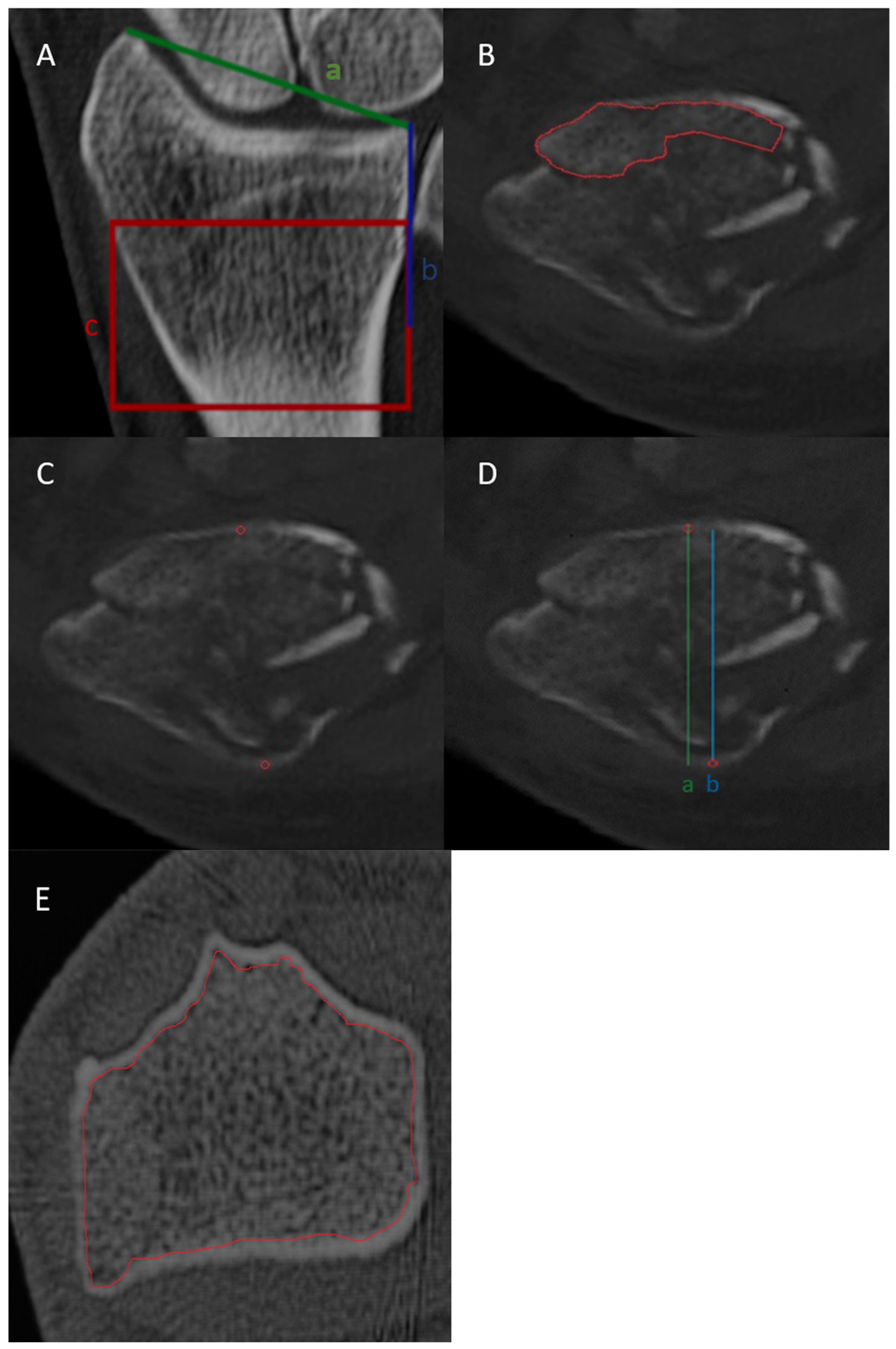 Diagnostics 14 00697 g001
