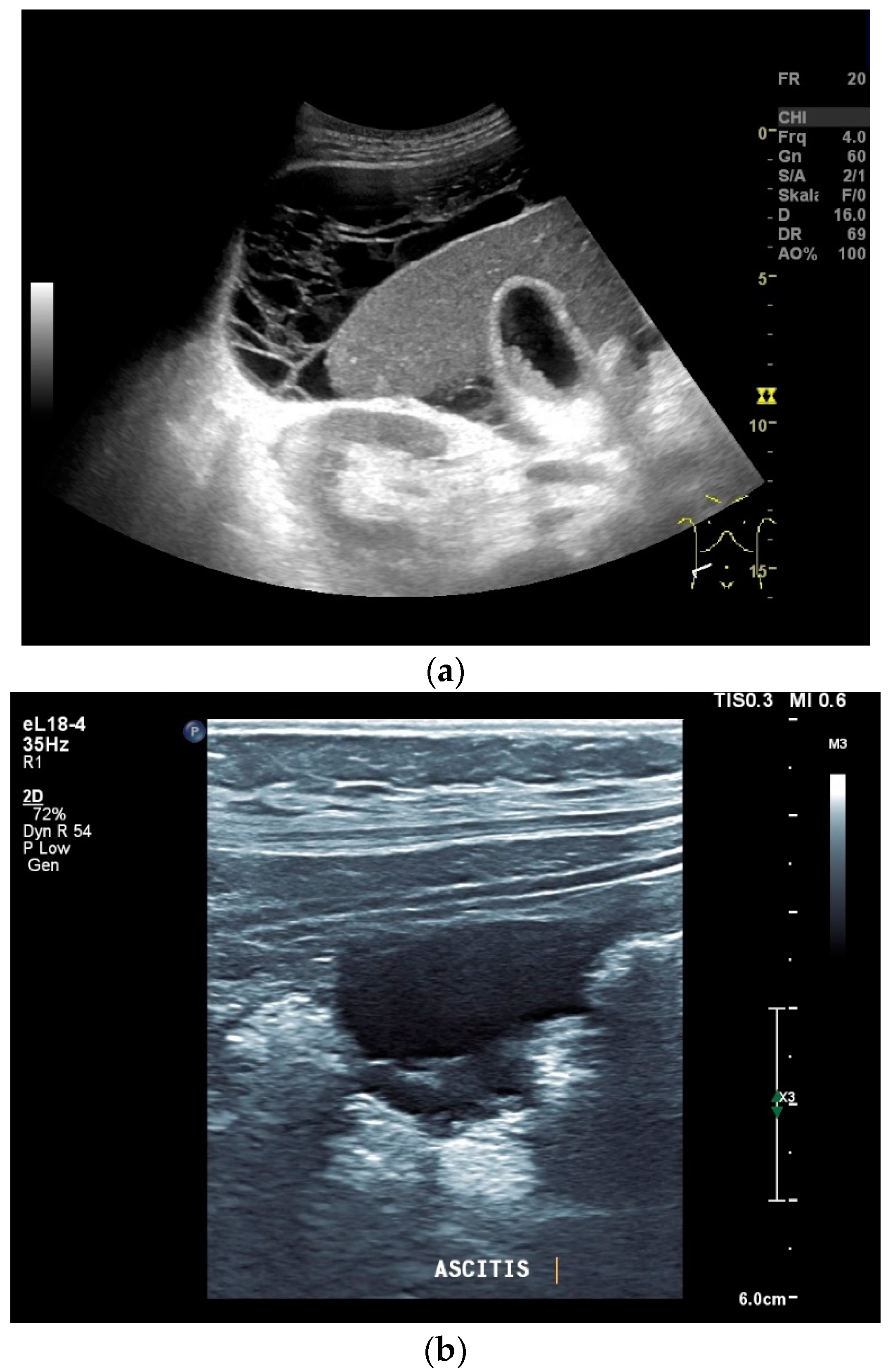 Diagnostics 14 00706 g001a
