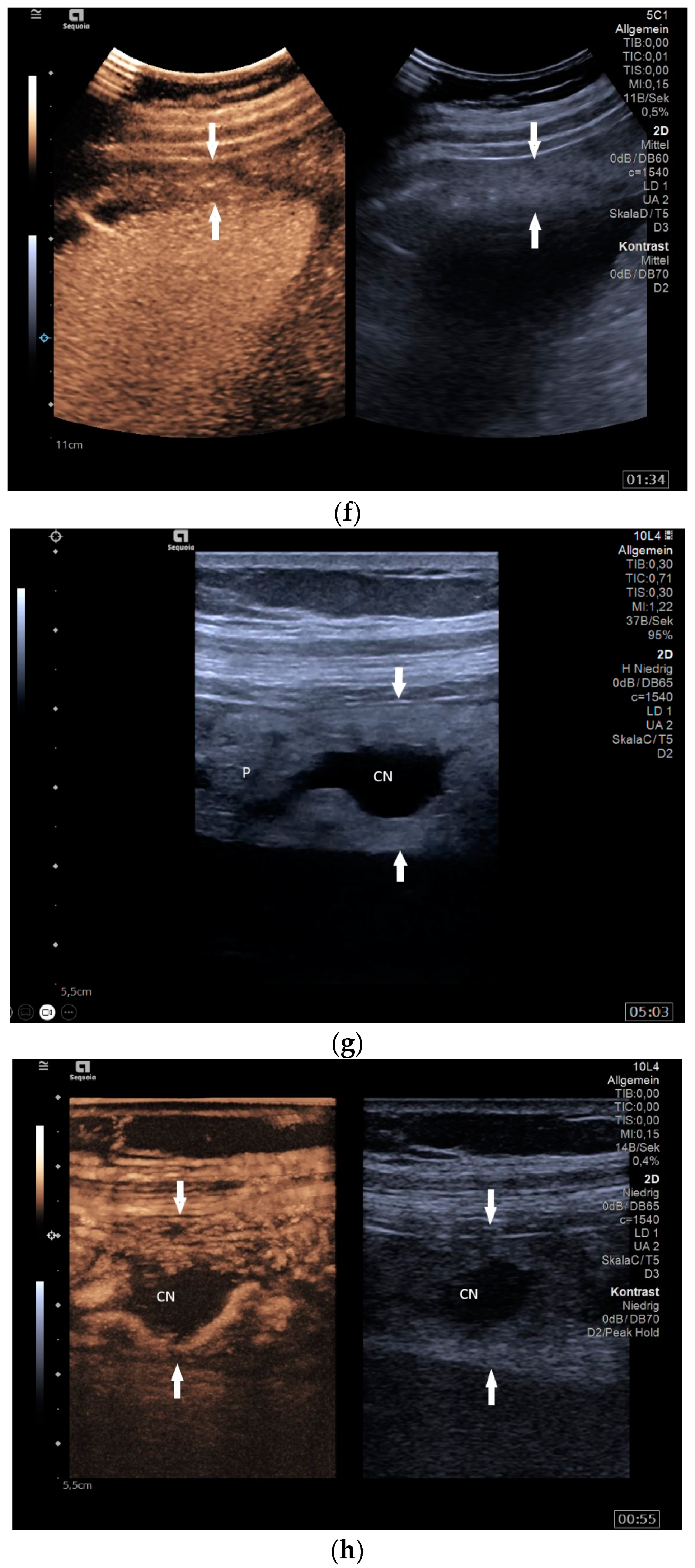 Diagnostics 14 00706 g001c