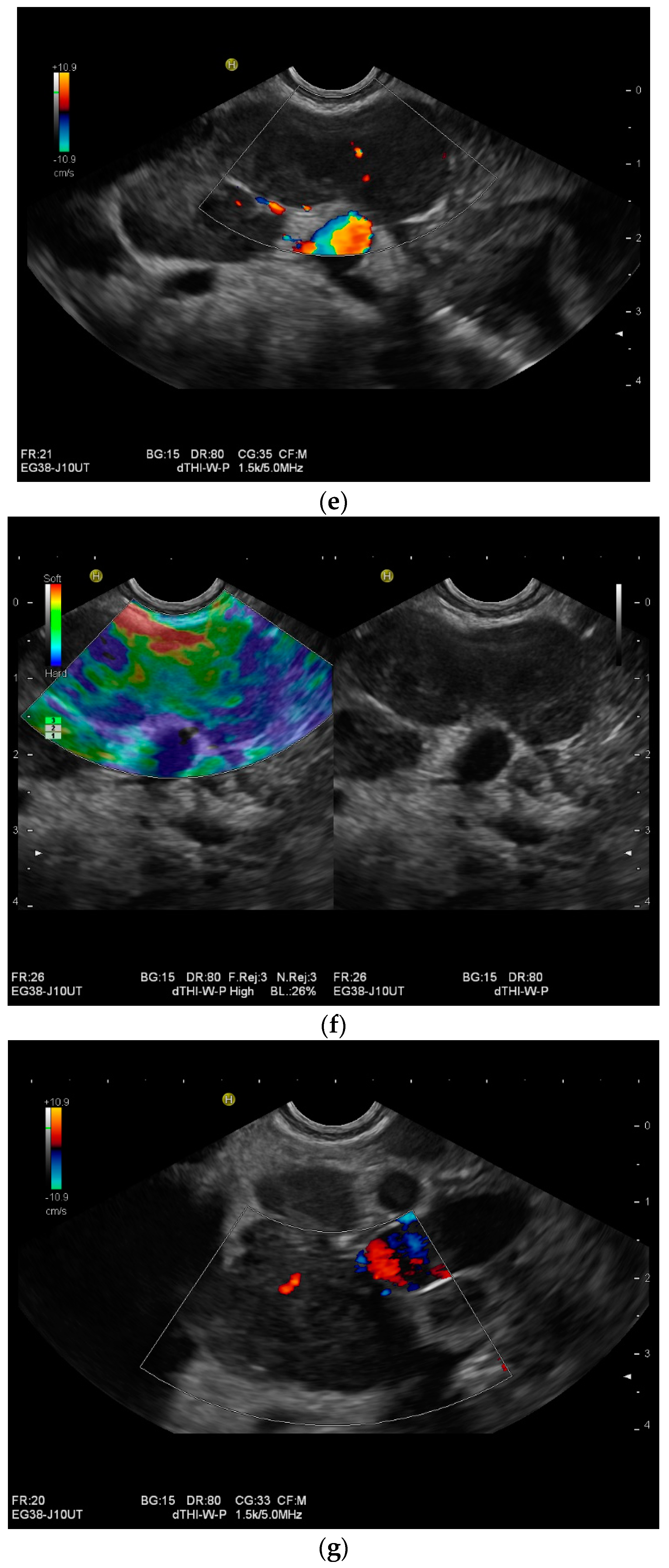 Diagnostics 14 00706 g002c