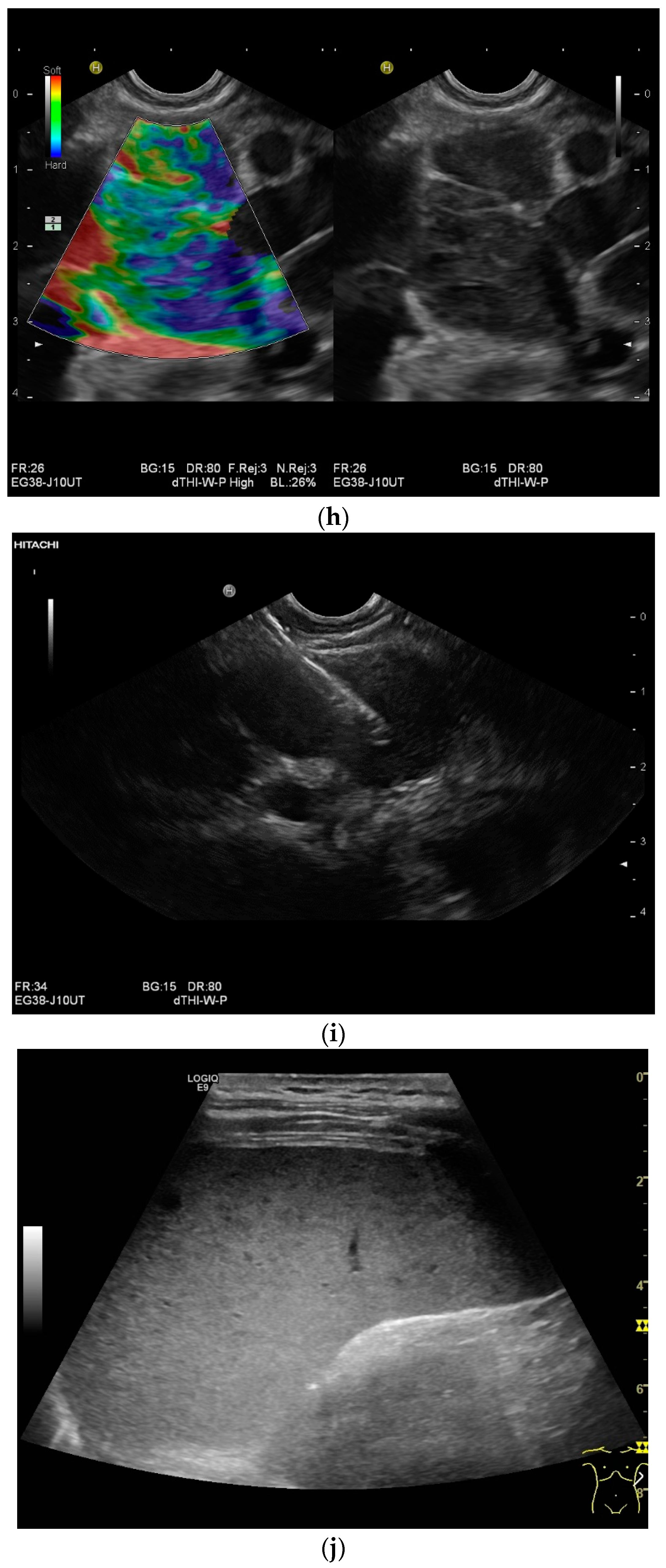 Diagnostics 14 00706 g002d
