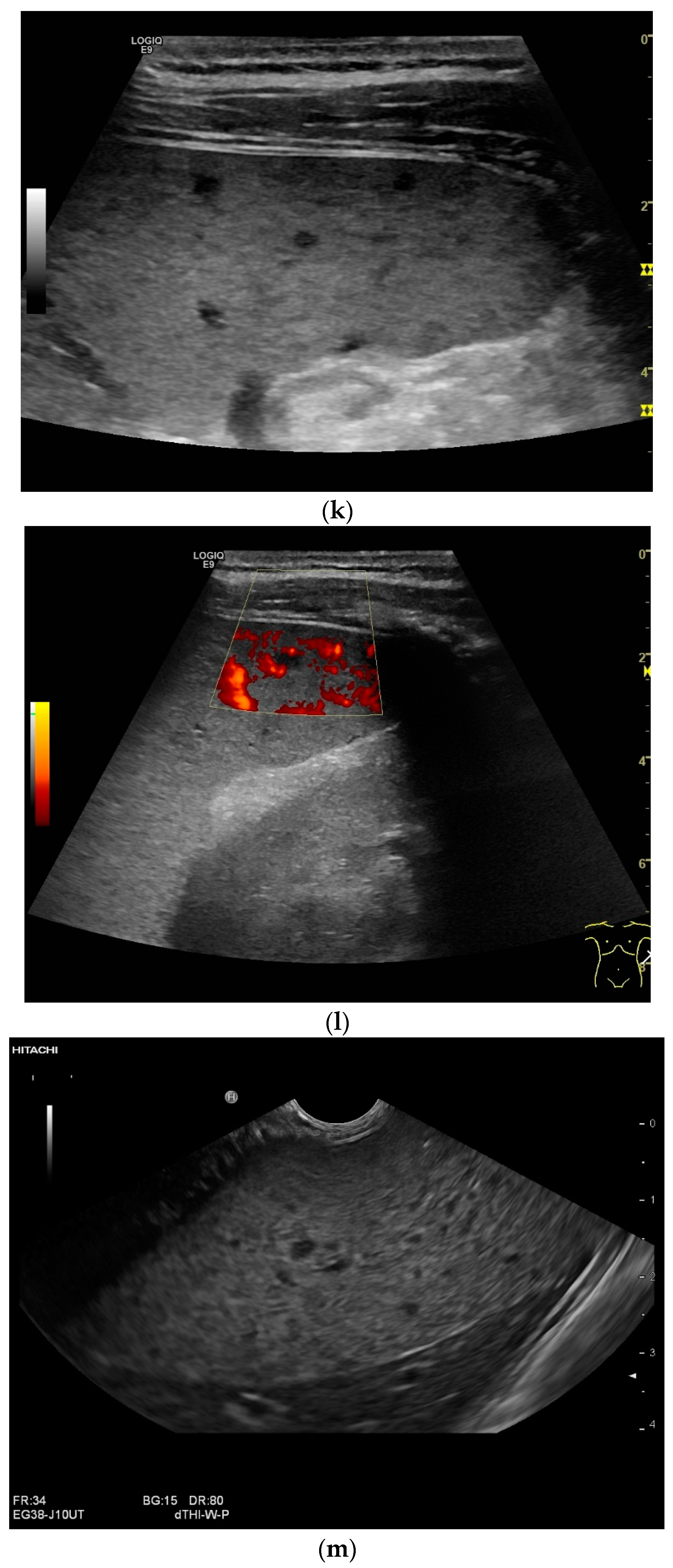 Diagnostics 14 00706 g002e