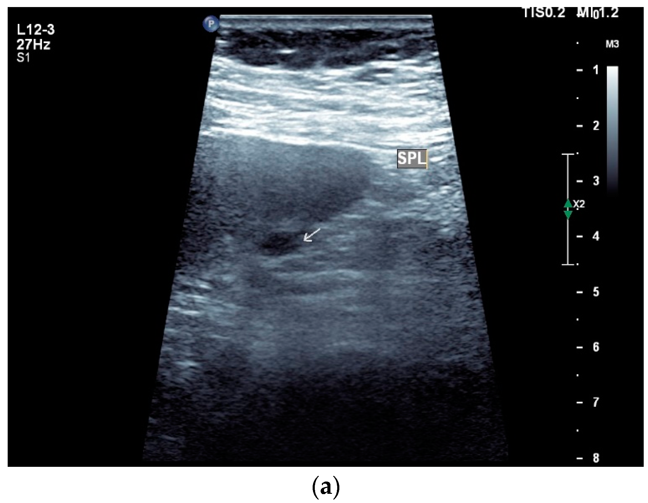 Diagnostics 14 00706 g004a