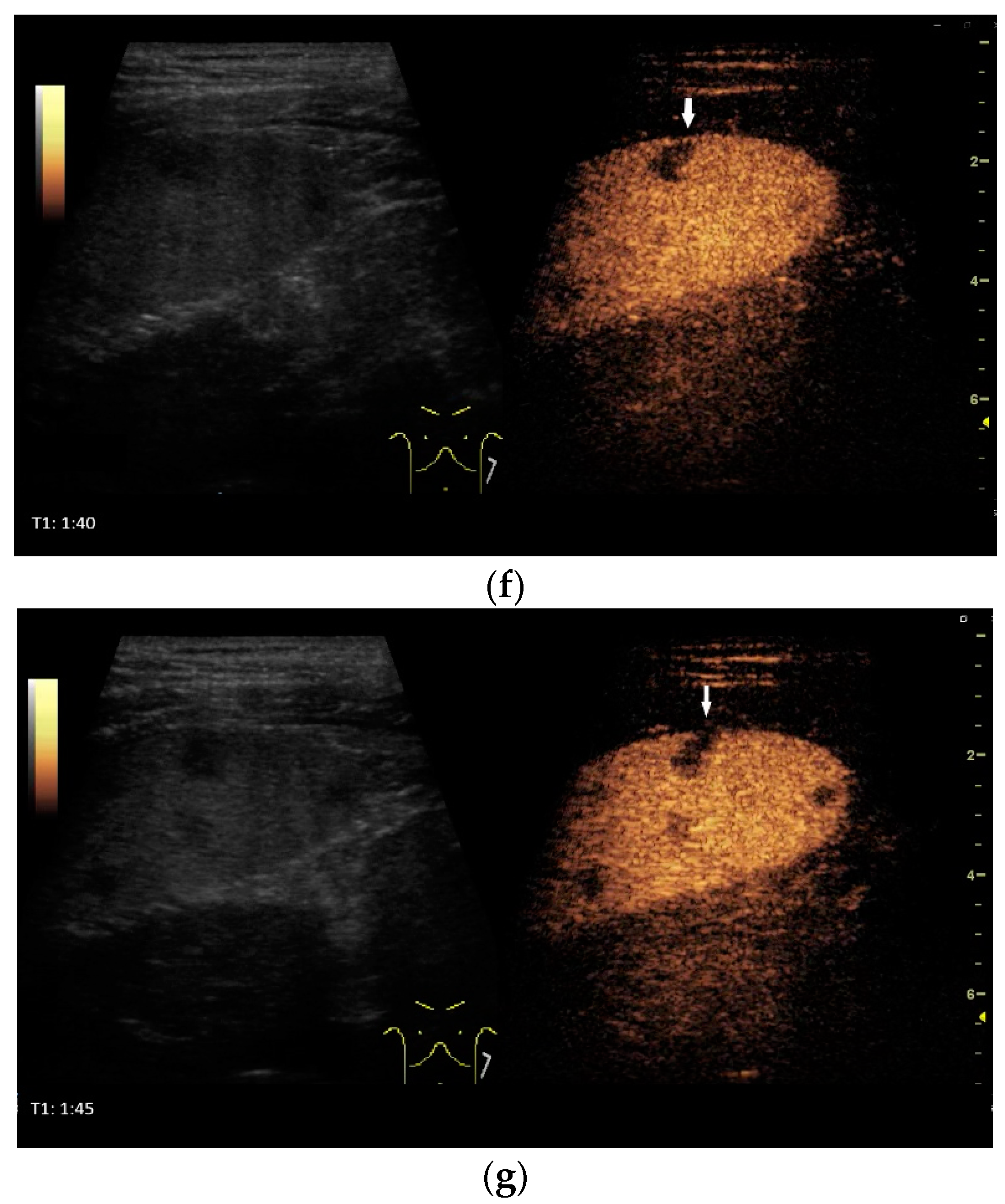 Diagnostics 14 00706 g004c