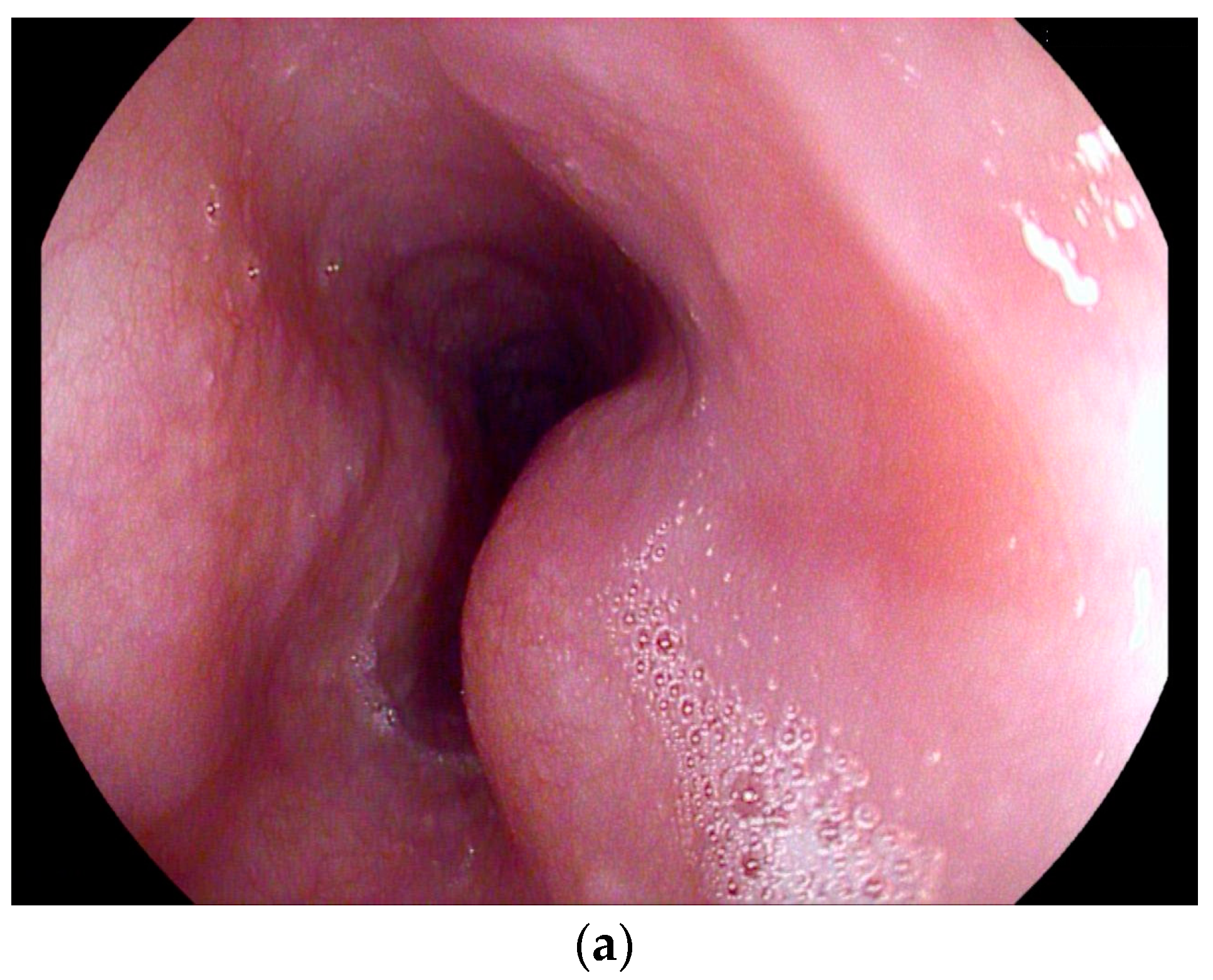 Diagnostics 14 00706 g006a