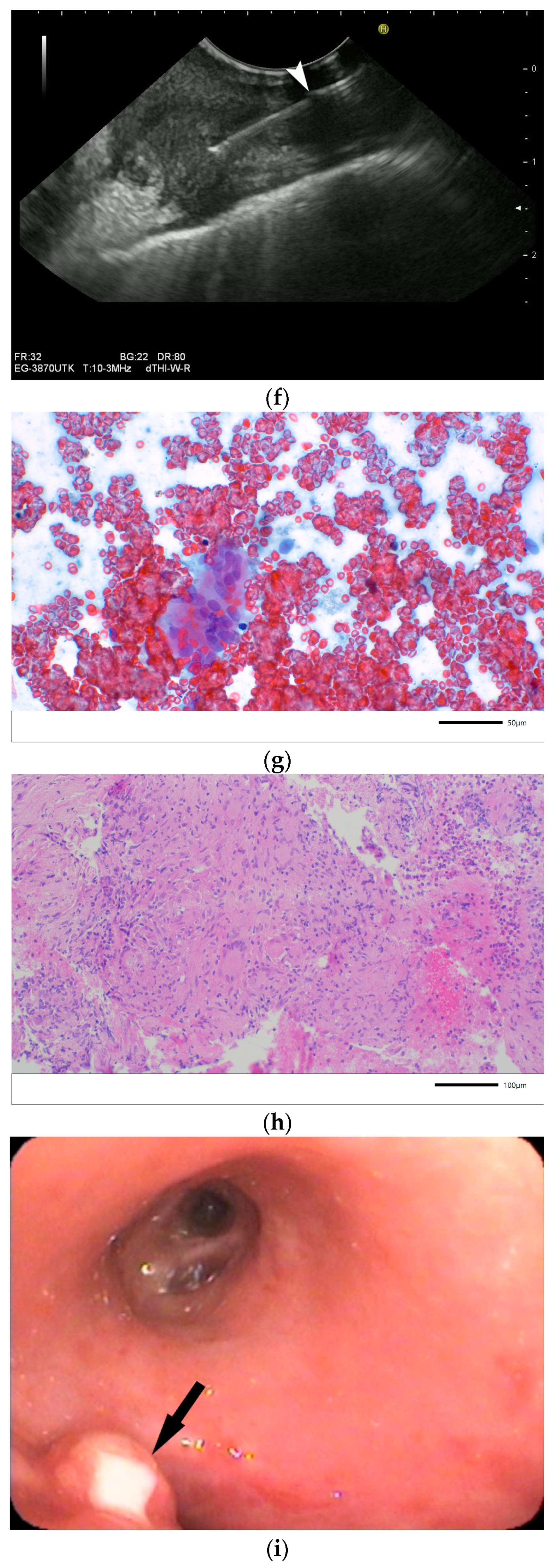 Diagnostics 14 00706 g006c