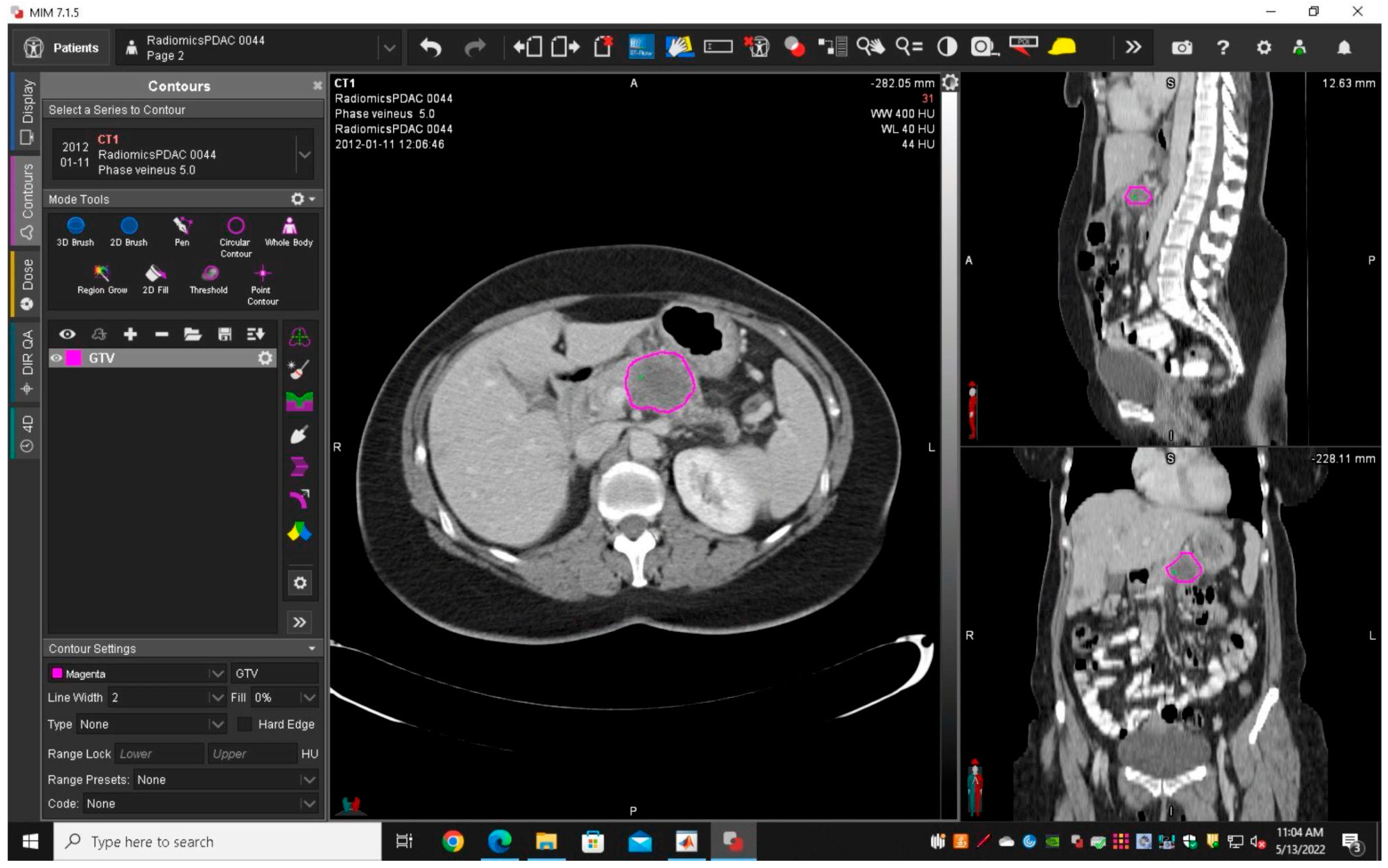 Diagnostics 14 00712 g001