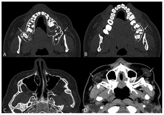 Diagnostics 14 00714 g002
