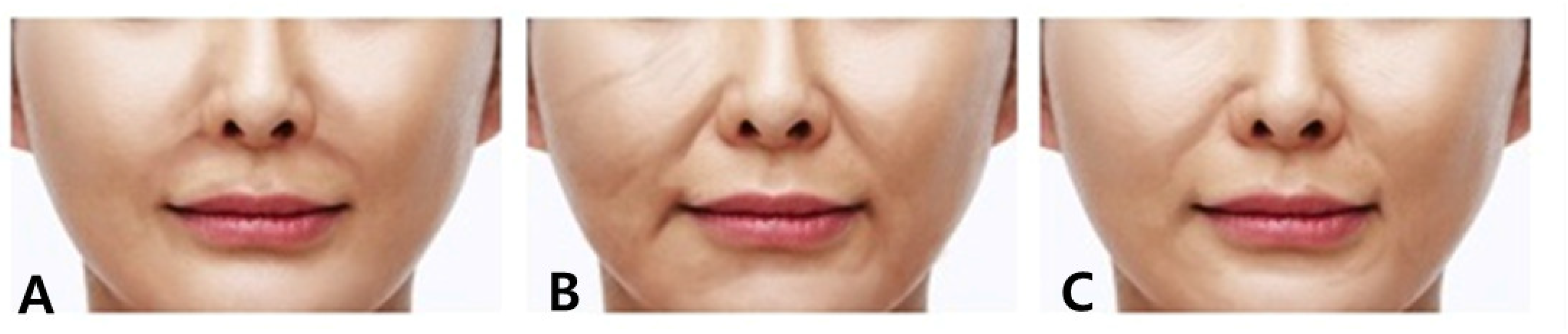 Diagnostics 14 00716 g001