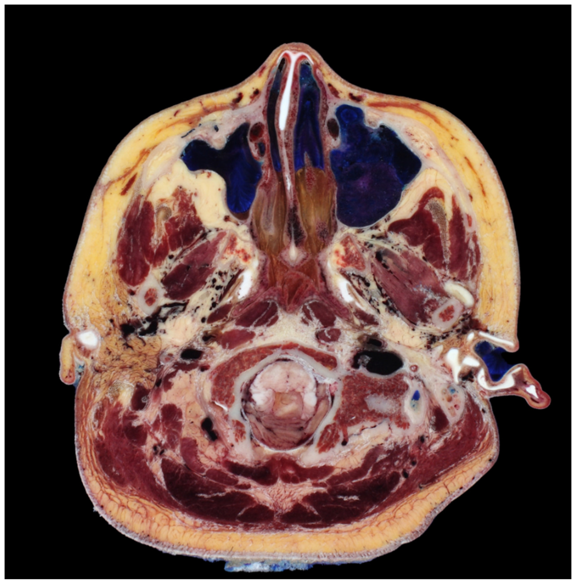 Diagnostics 14 00716 g005