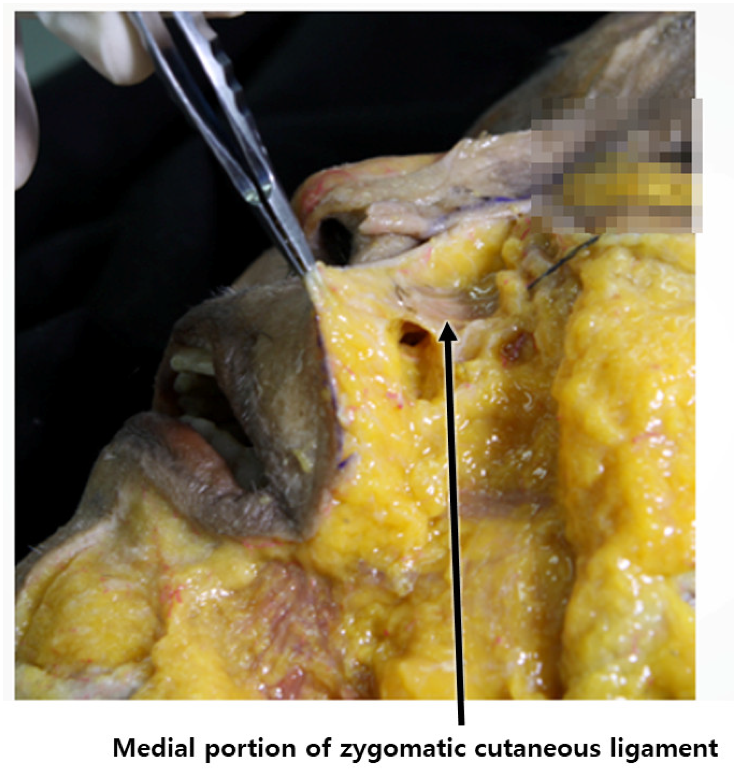 Diagnostics 14 00716 g015