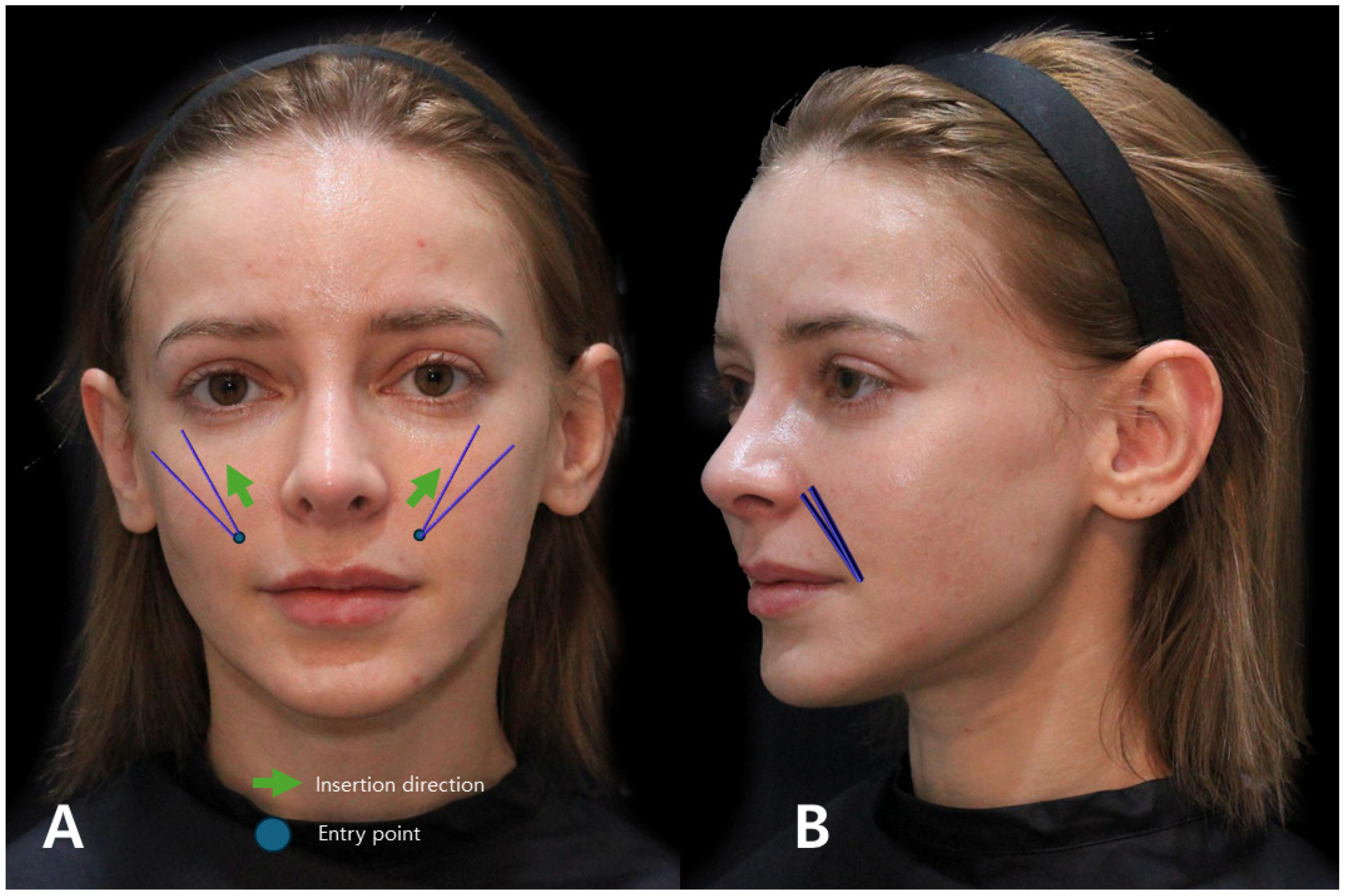 Diagnostics 14 00716 g018