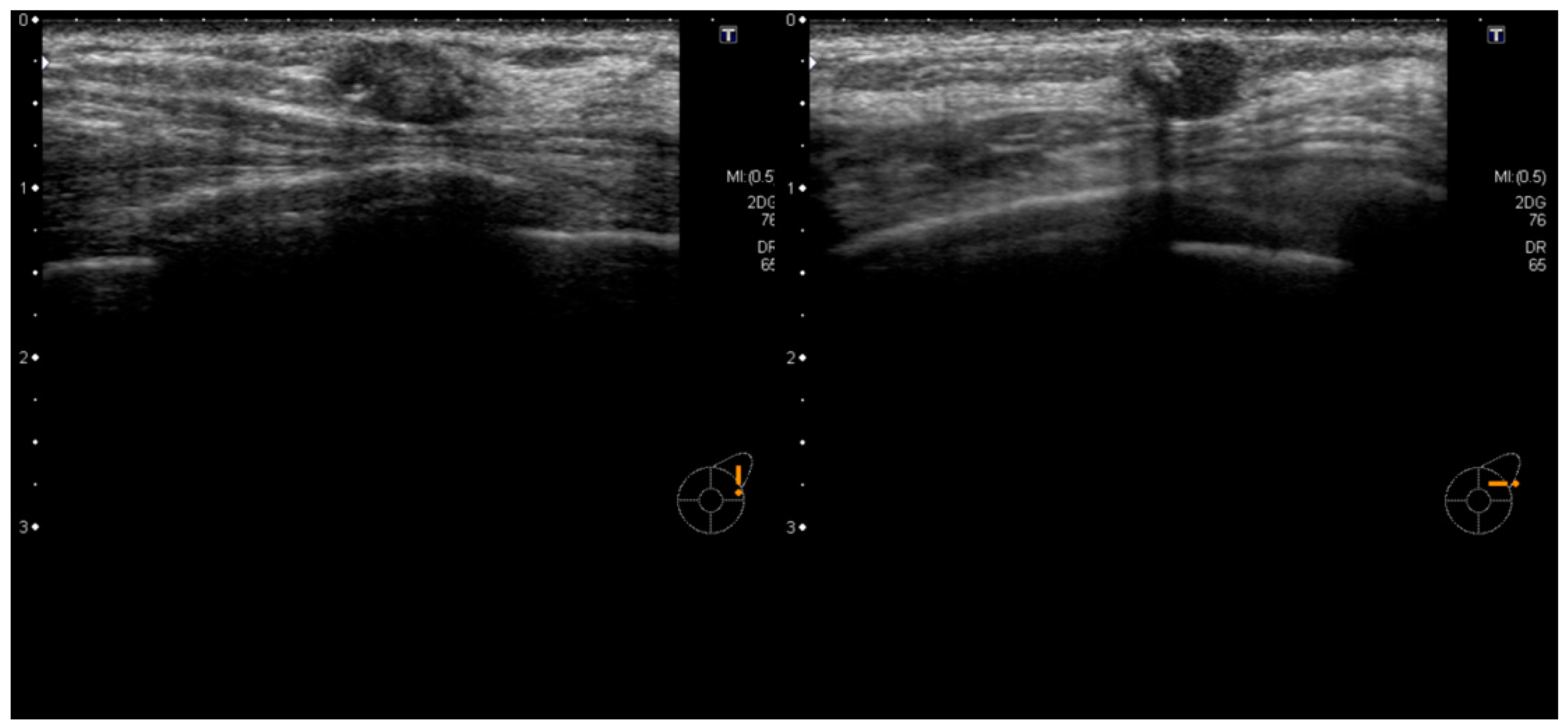Diagnostics 14 00727 g002 Diagnostics 14 00727 g002
