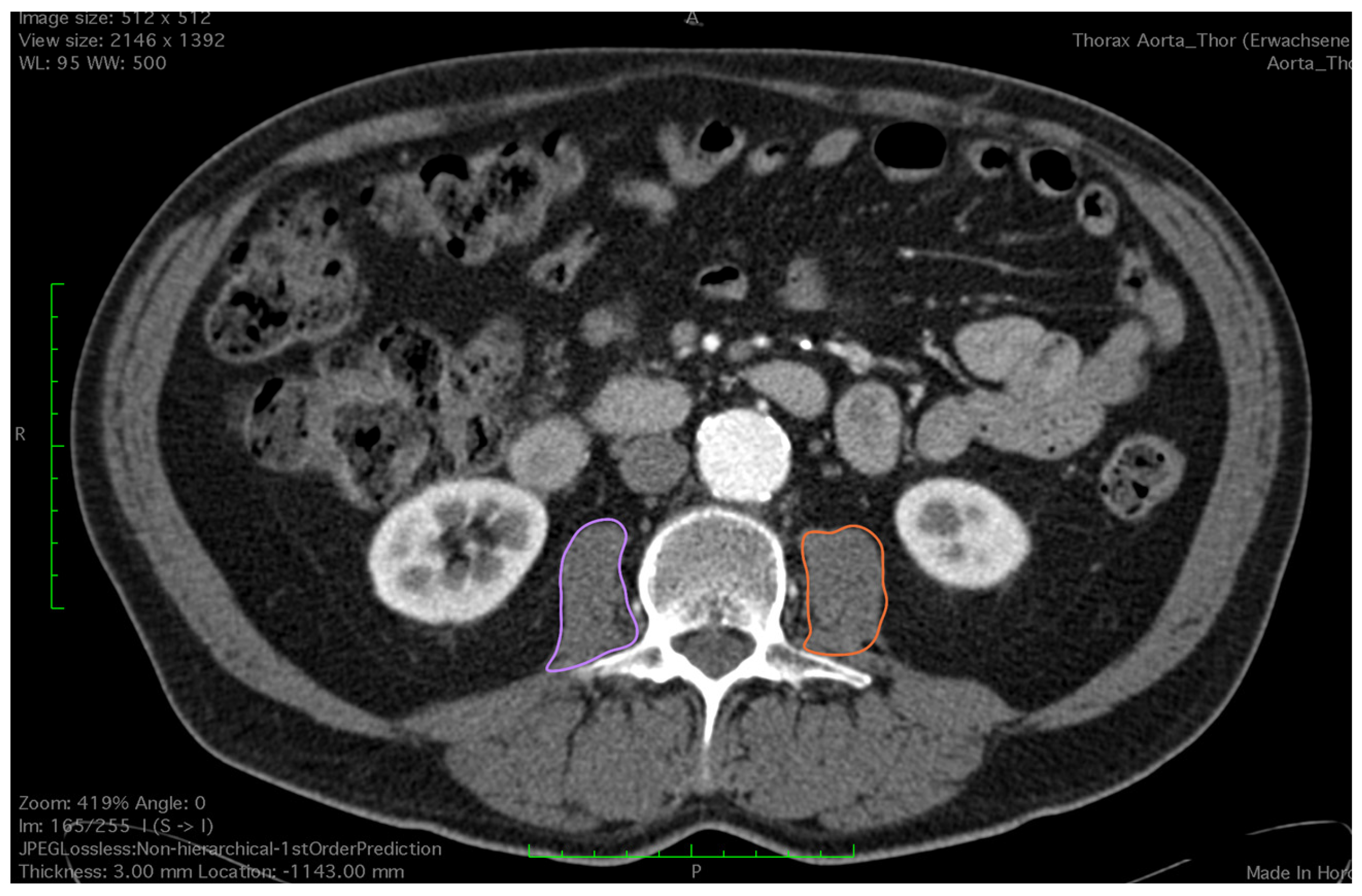 Diagnostics 14 00751 g002