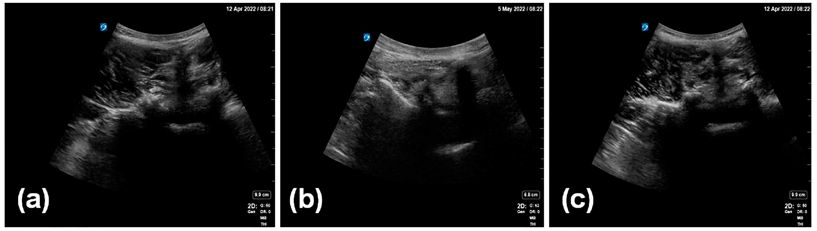 Diagnostics 14 00755 g002 Diagnostics 14 00755 g002
