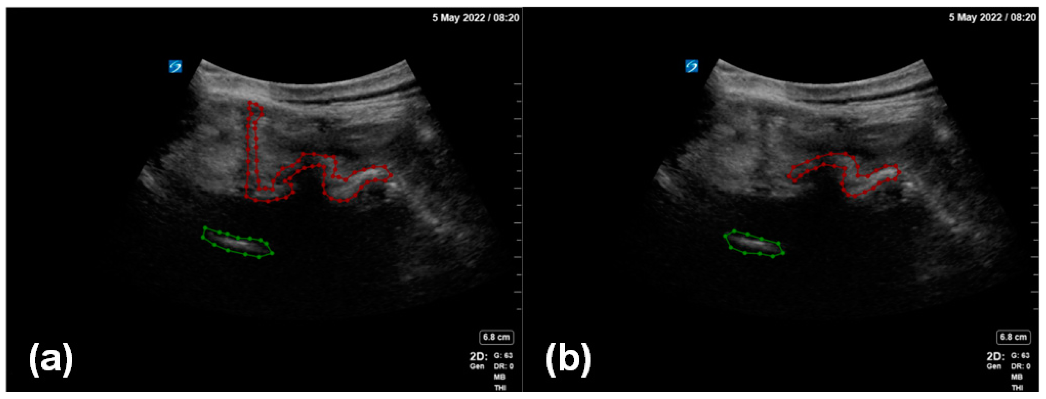 Diagnostics 14 00755 g003 Diagnostics 14 00755 g003