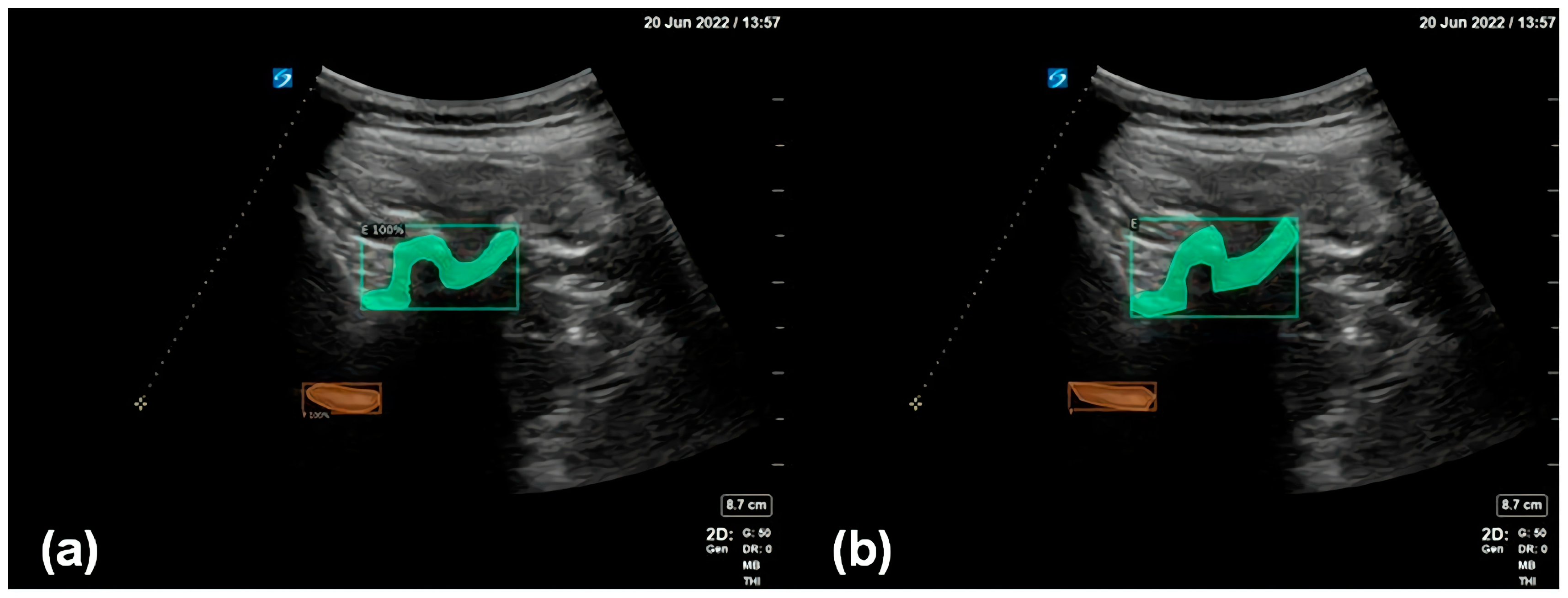 Diagnostics 14 00755 g005 Diagnostics 14 00755 g005
