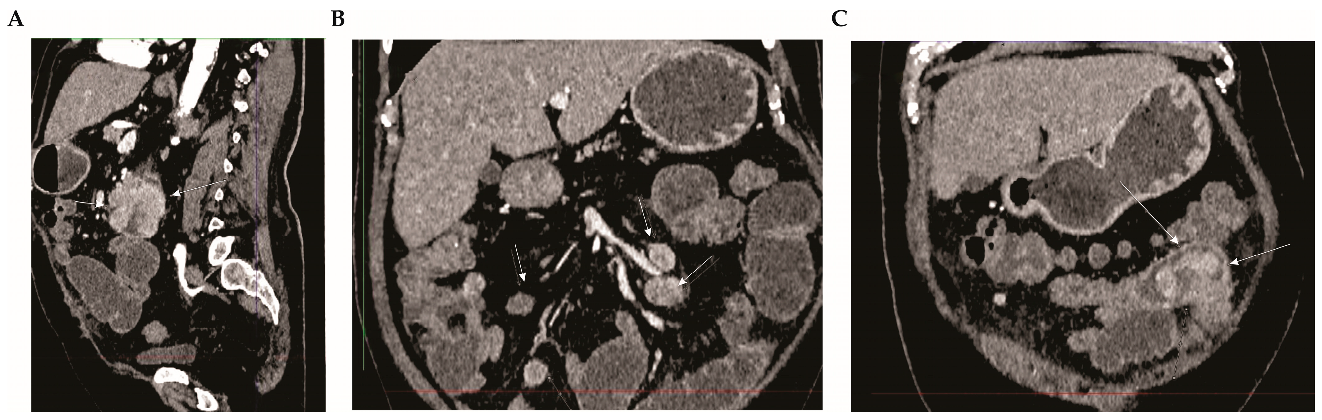 Diagnostics 14 00761 g001