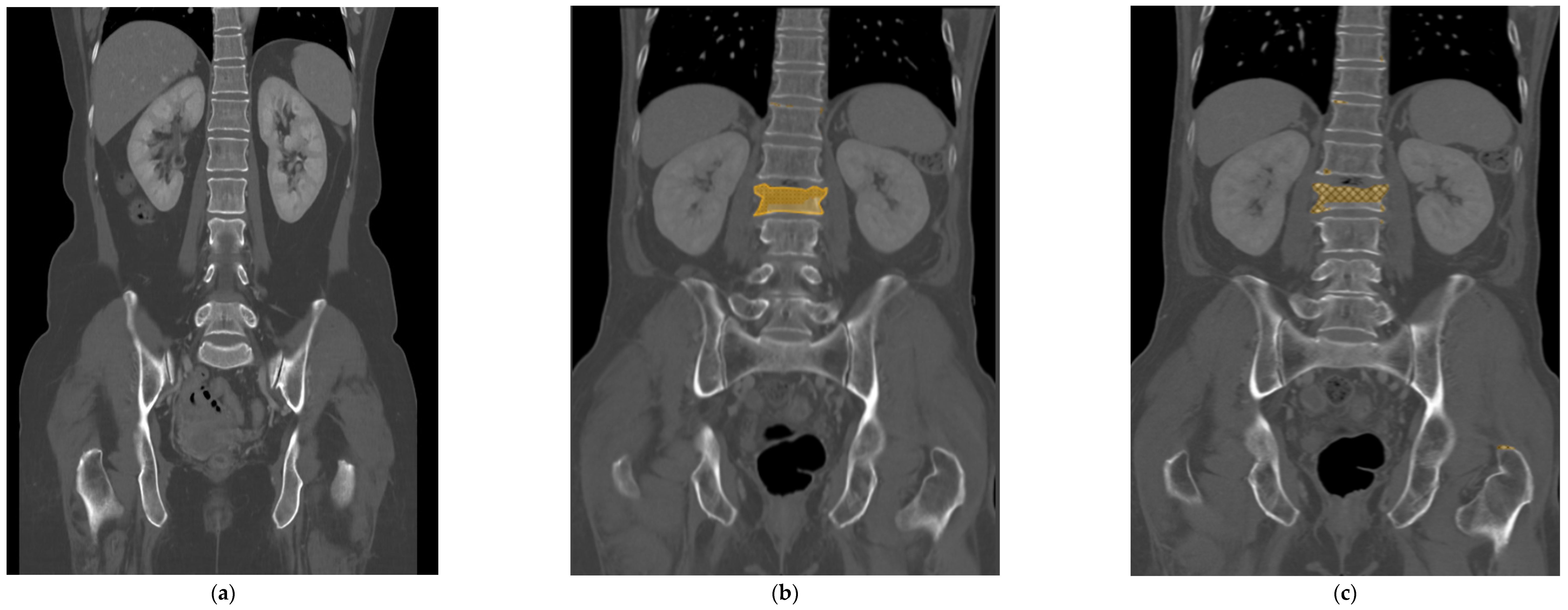 Diagnostics 14 00781 g002