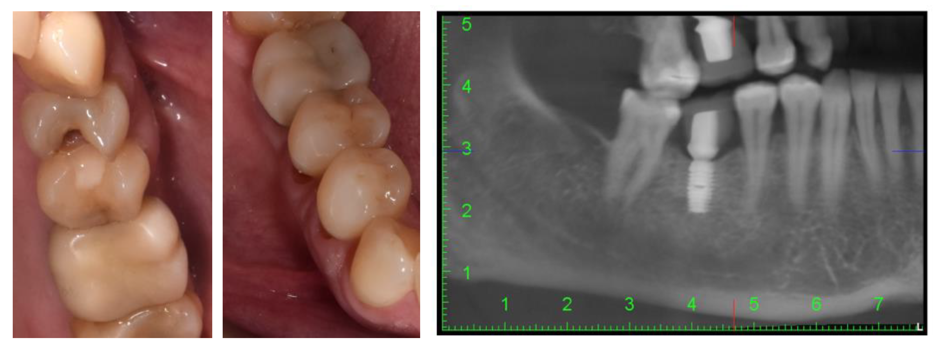 Diagnostics 14 00788 g001 Diagnostics 14 00788 g001