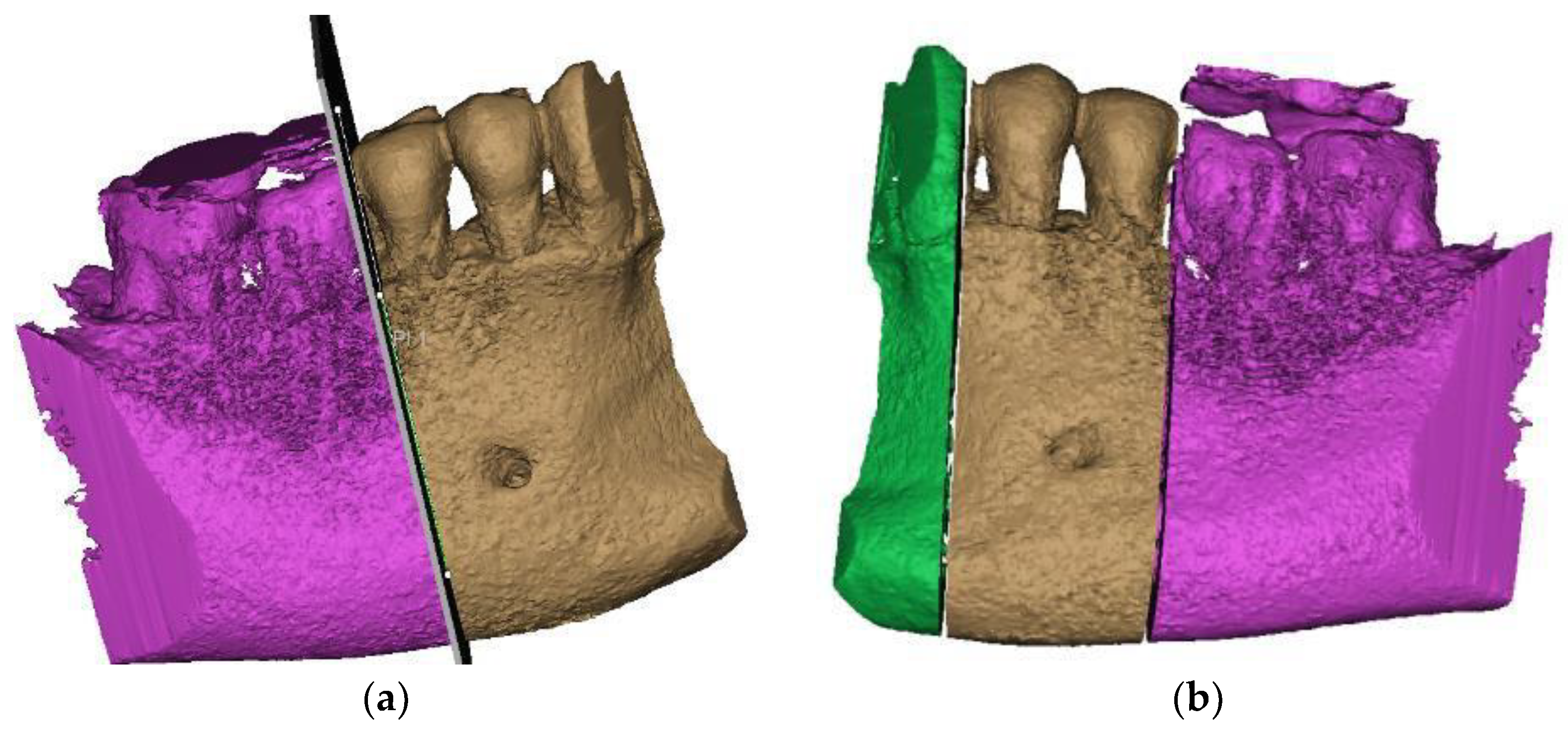 Diagnostics 14 00788 g003 Diagnostics 14 00788 g003