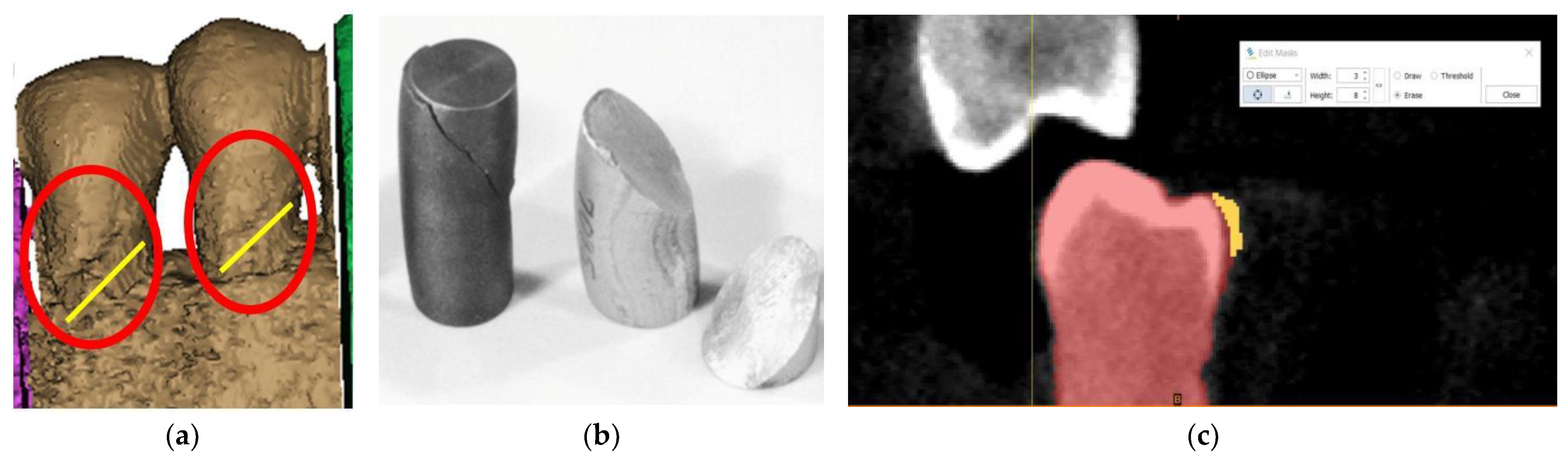 Diagnostics 14 00788 g004 Diagnostics 14 00788 g004