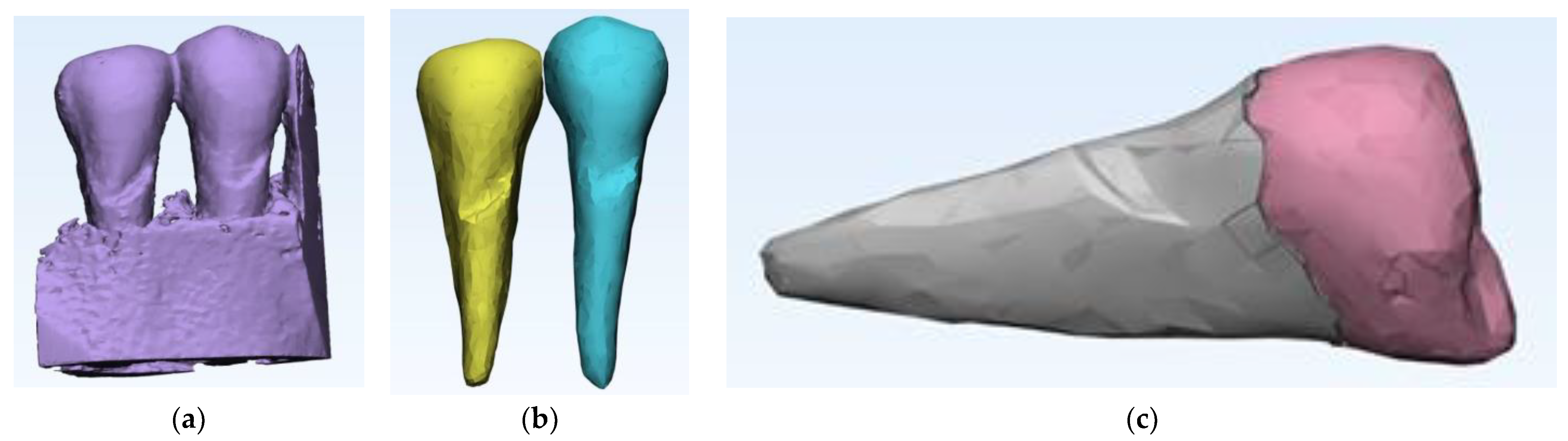 Diagnostics 14 00788 g005 Diagnostics 14 00788 g005