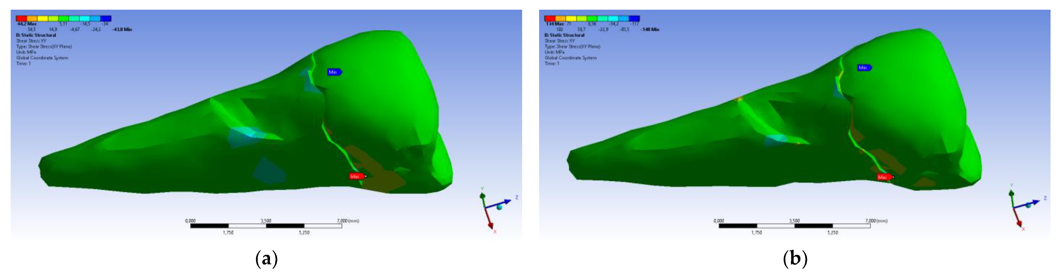Diagnostics 14 00788 g028 Diagnostics 14 00788 g028