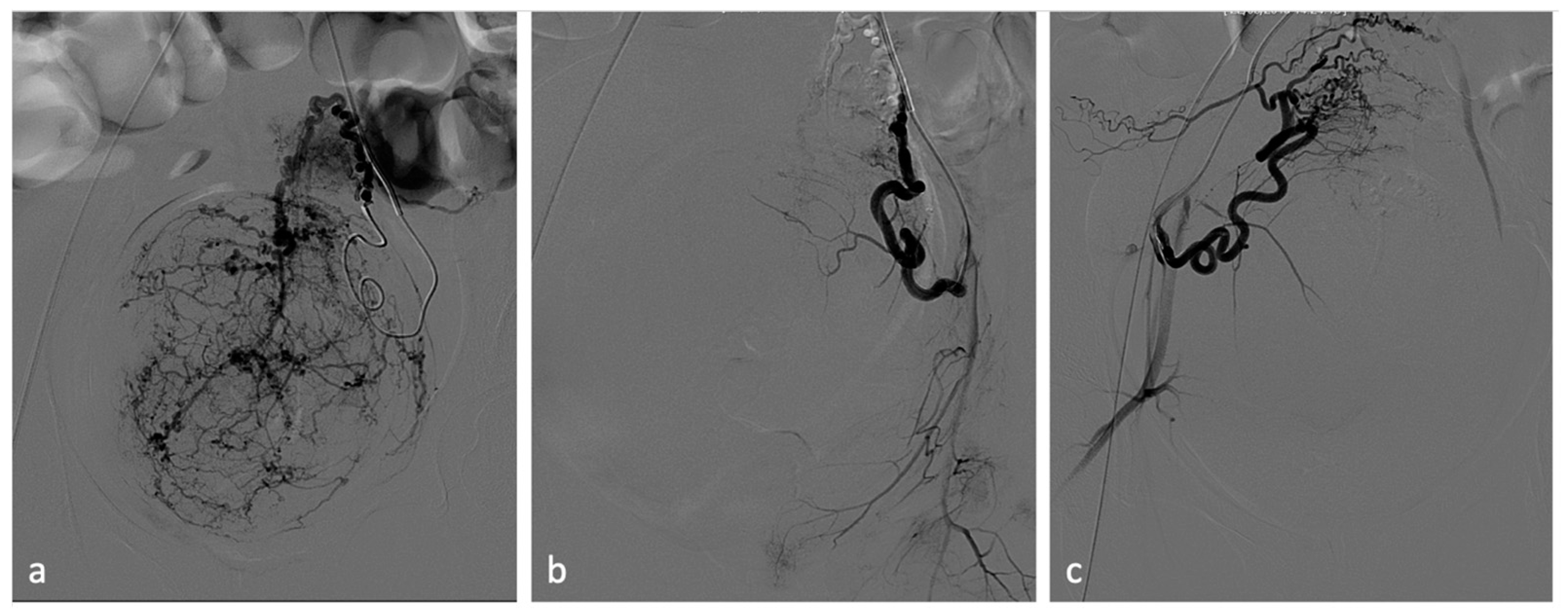 Diagnostics 14 00798 g004
