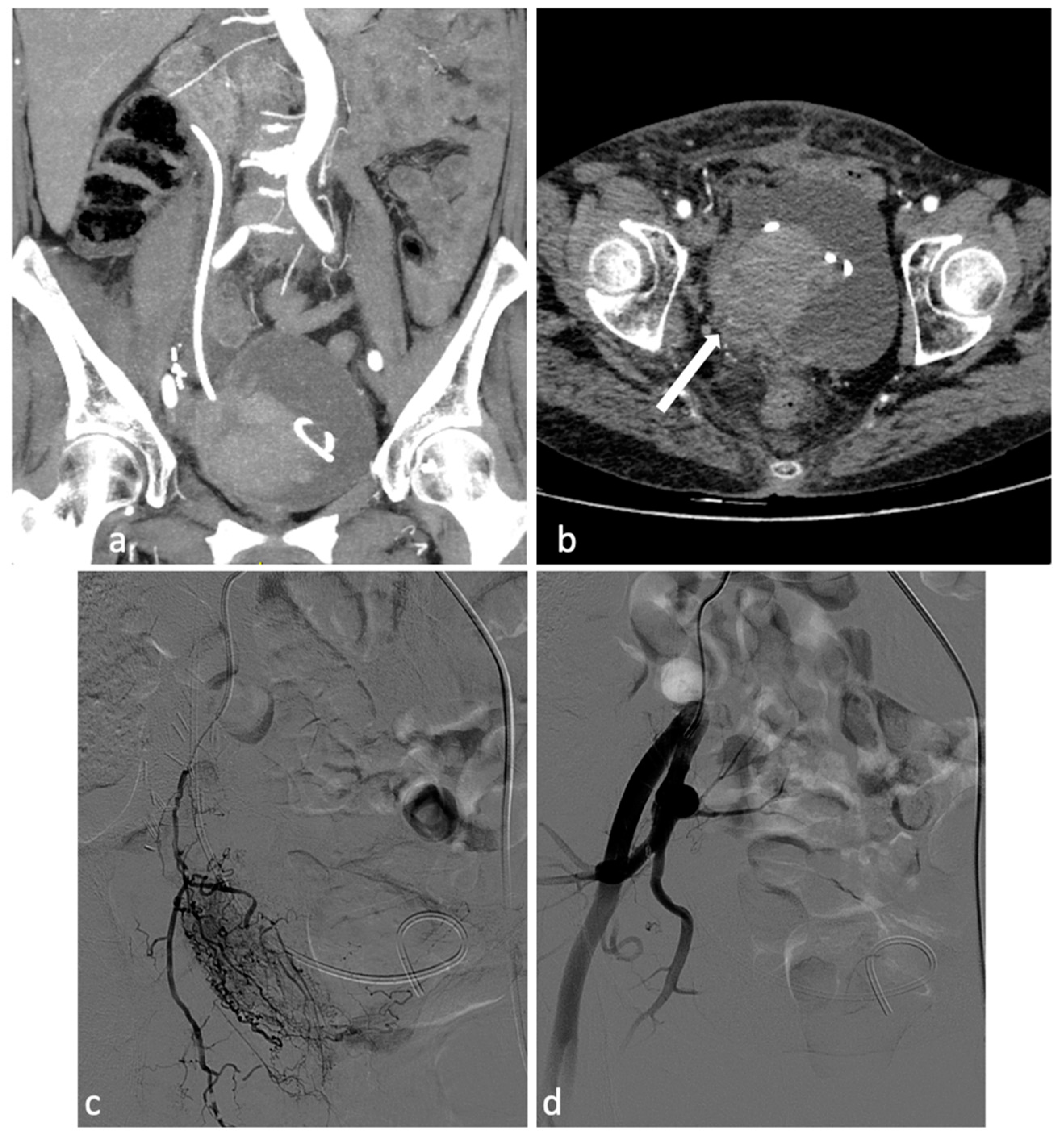 Diagnostics 14 00798 g005