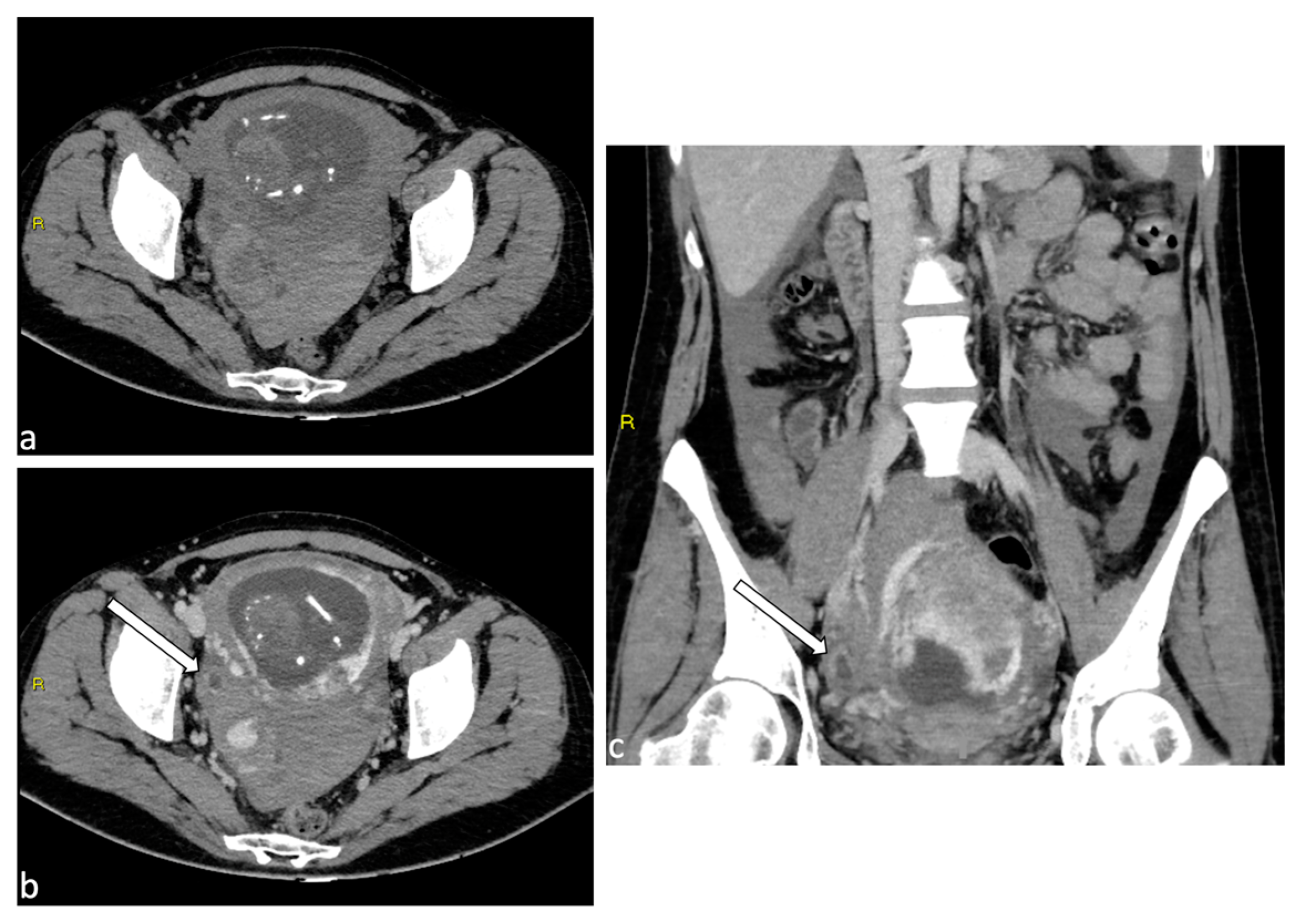 Diagnostics 14 00798 g007