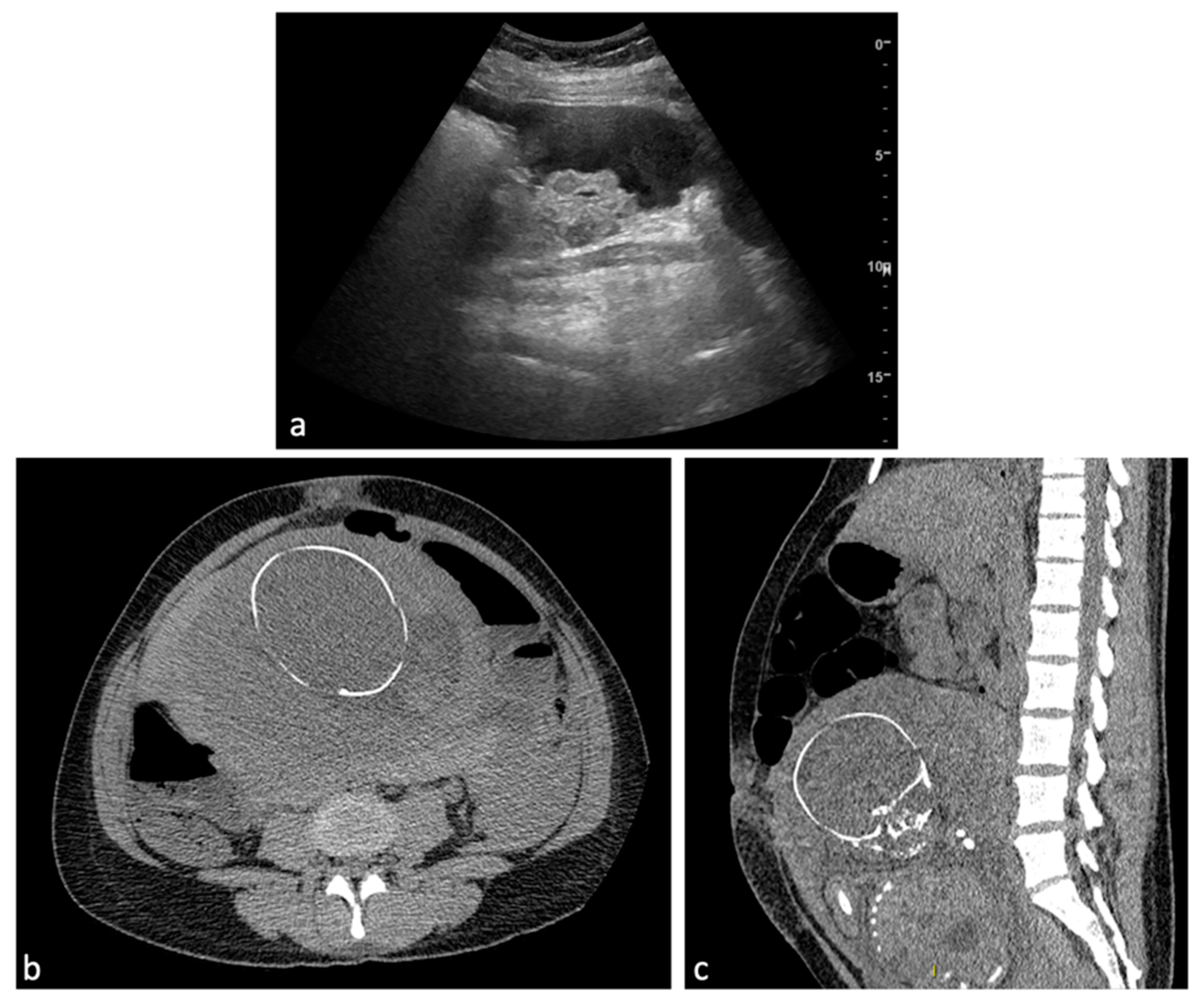 Diagnostics 14 00798 g008