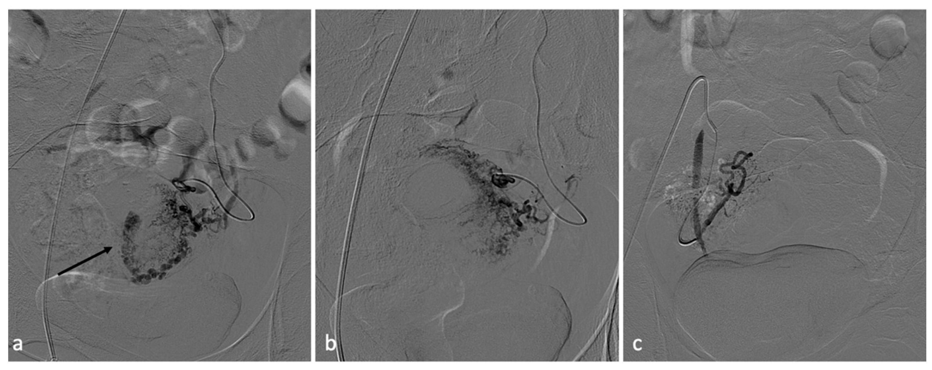 Diagnostics 14 00798 g010