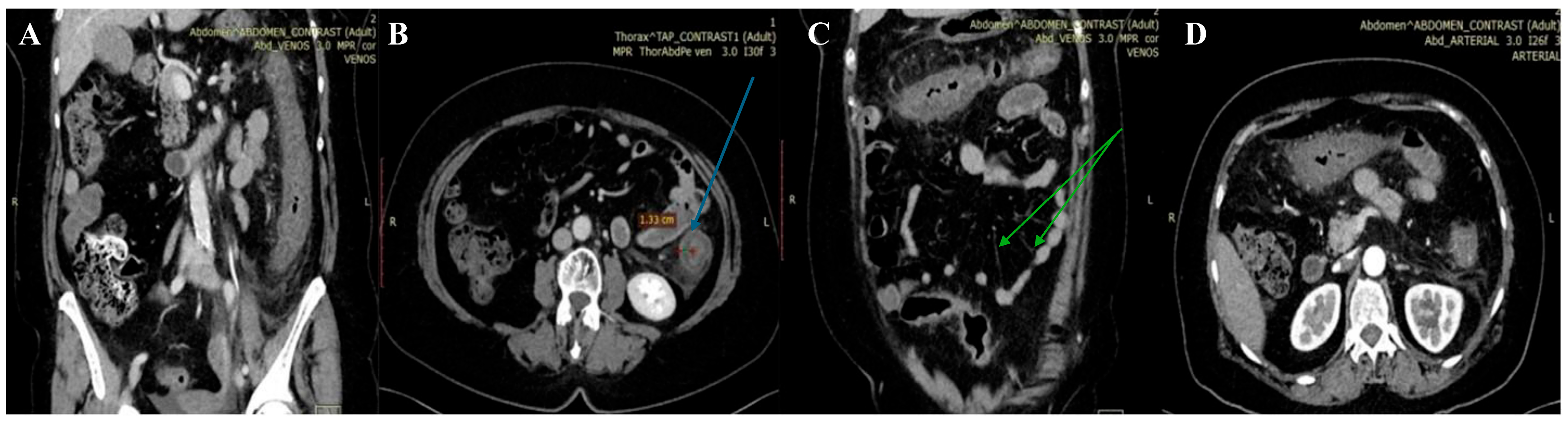 Diagnostics 14 00801 g001