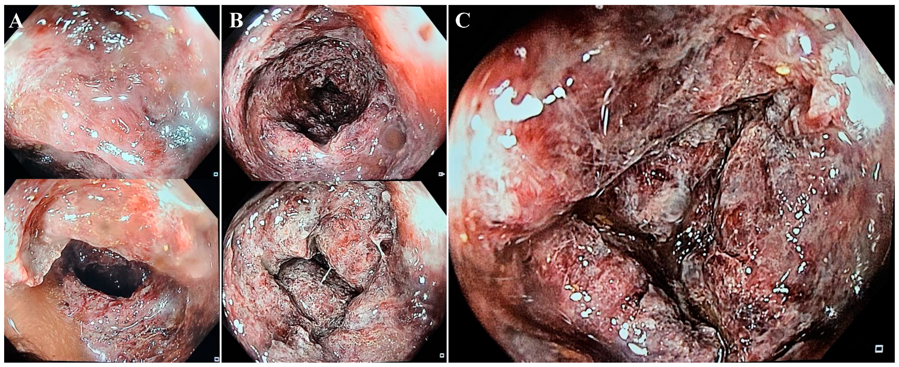 Diagnostics 14 00801 g003