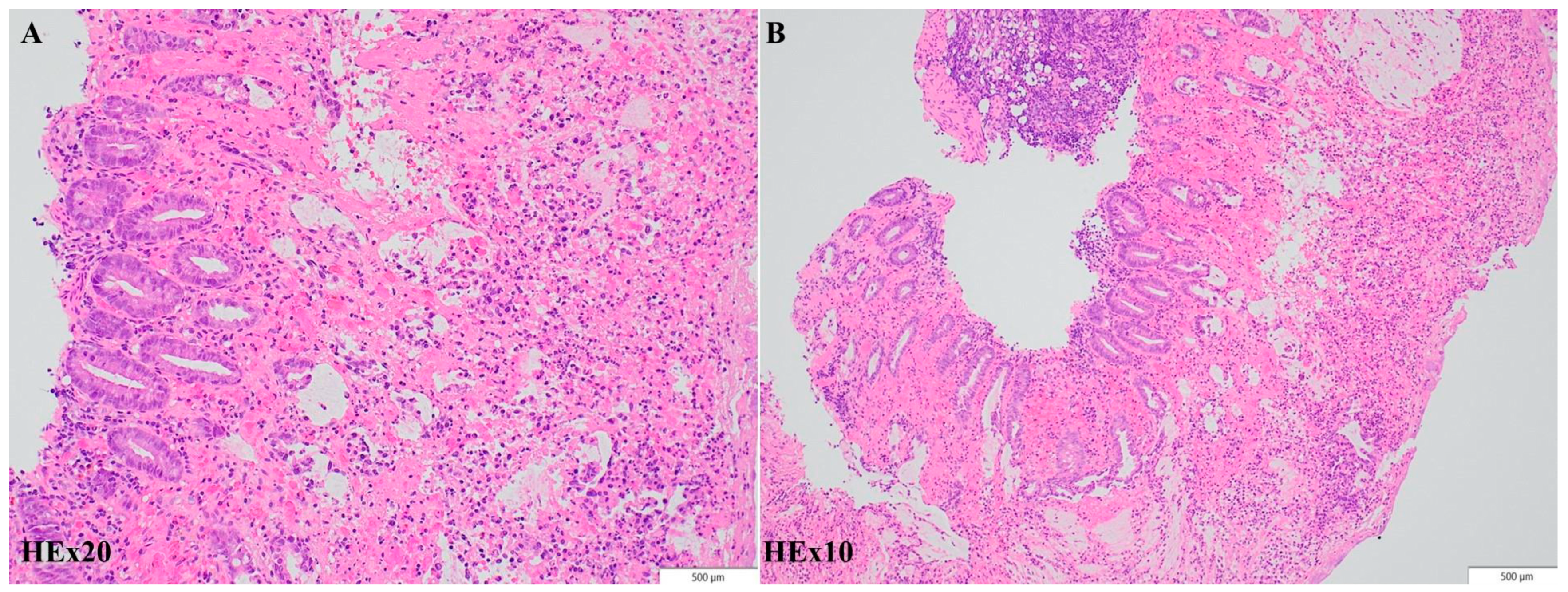 Diagnostics 14 00801 g004