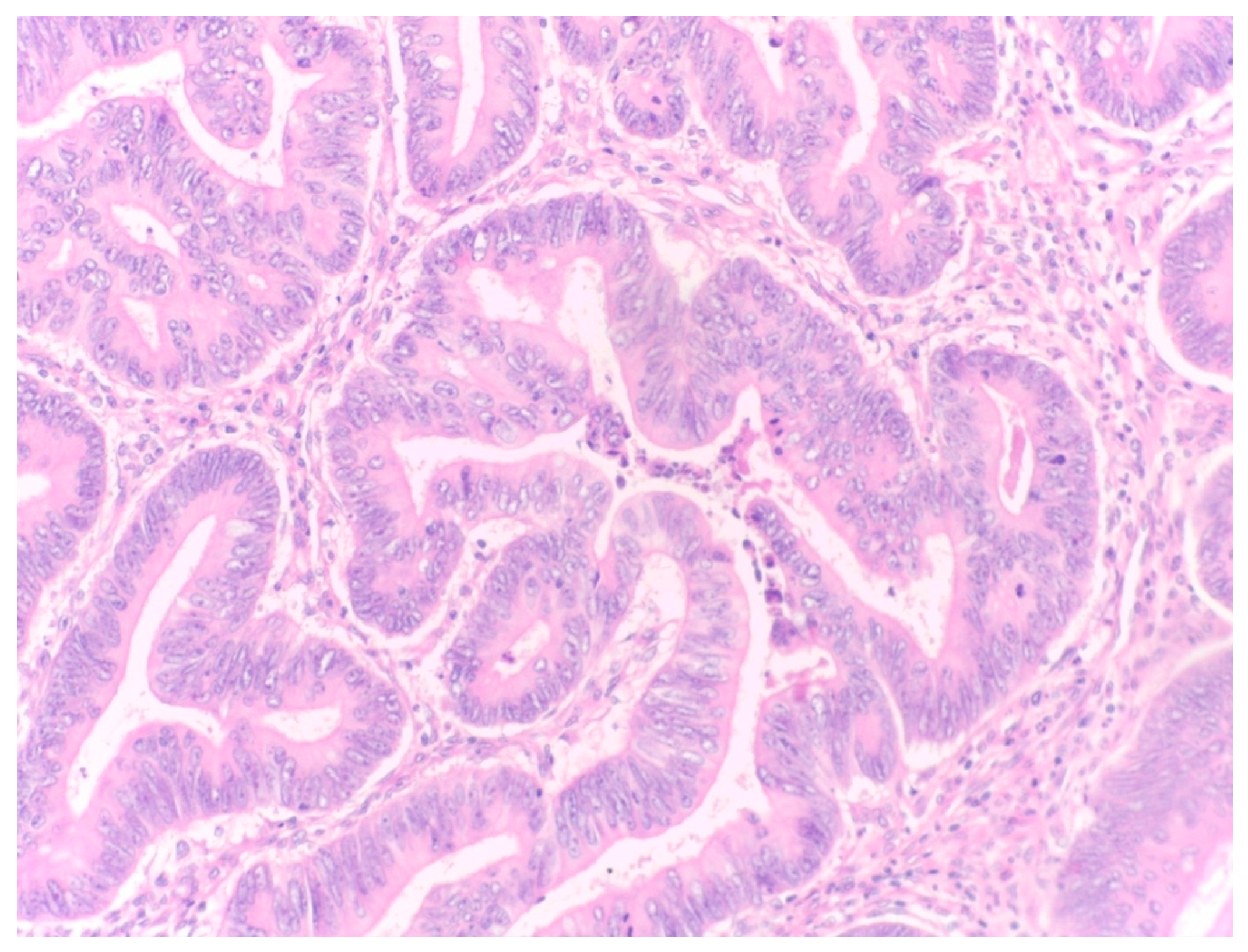 Diagnostics 14 00836 g001