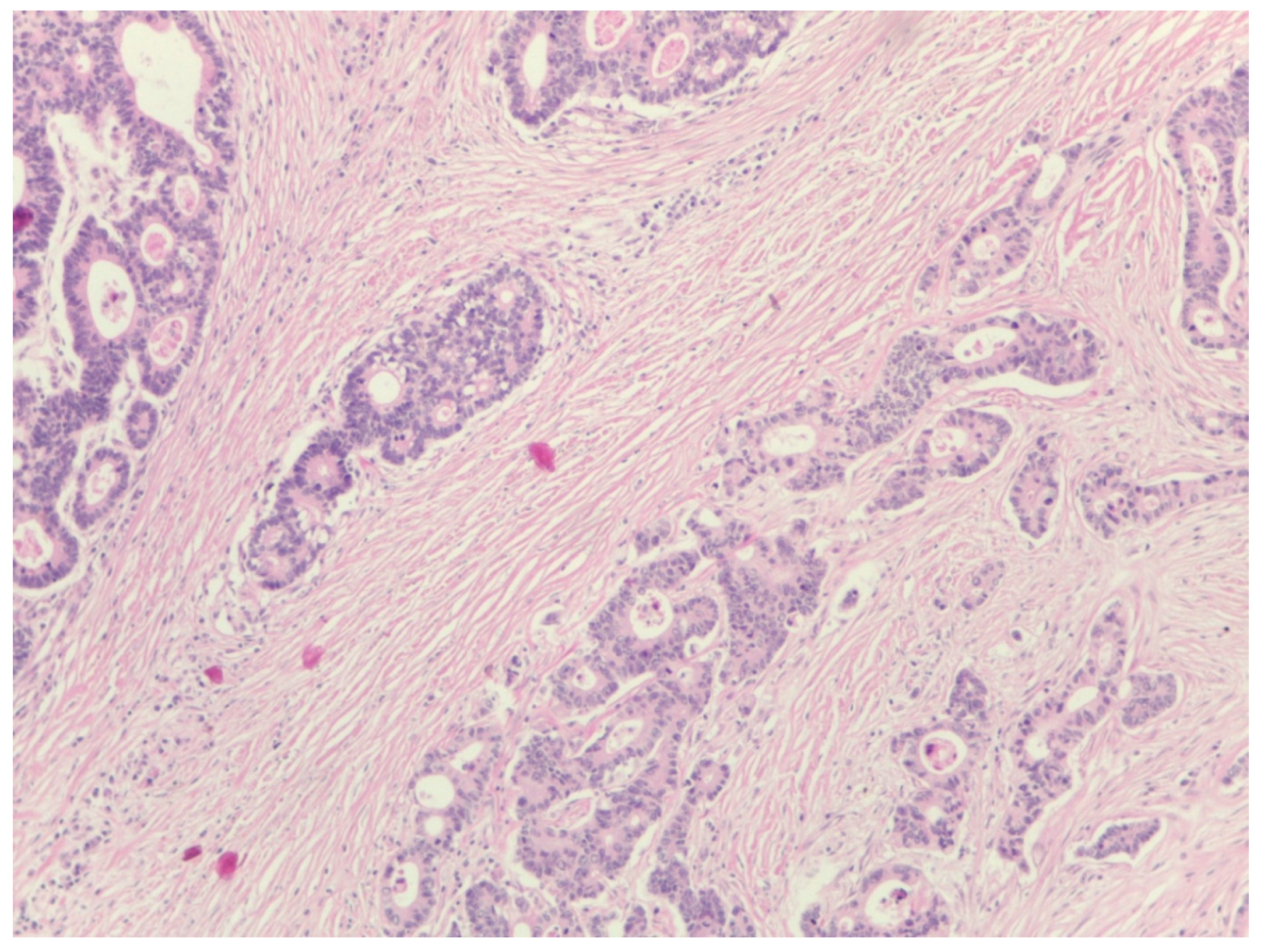 Diagnostics 14 00836 g002