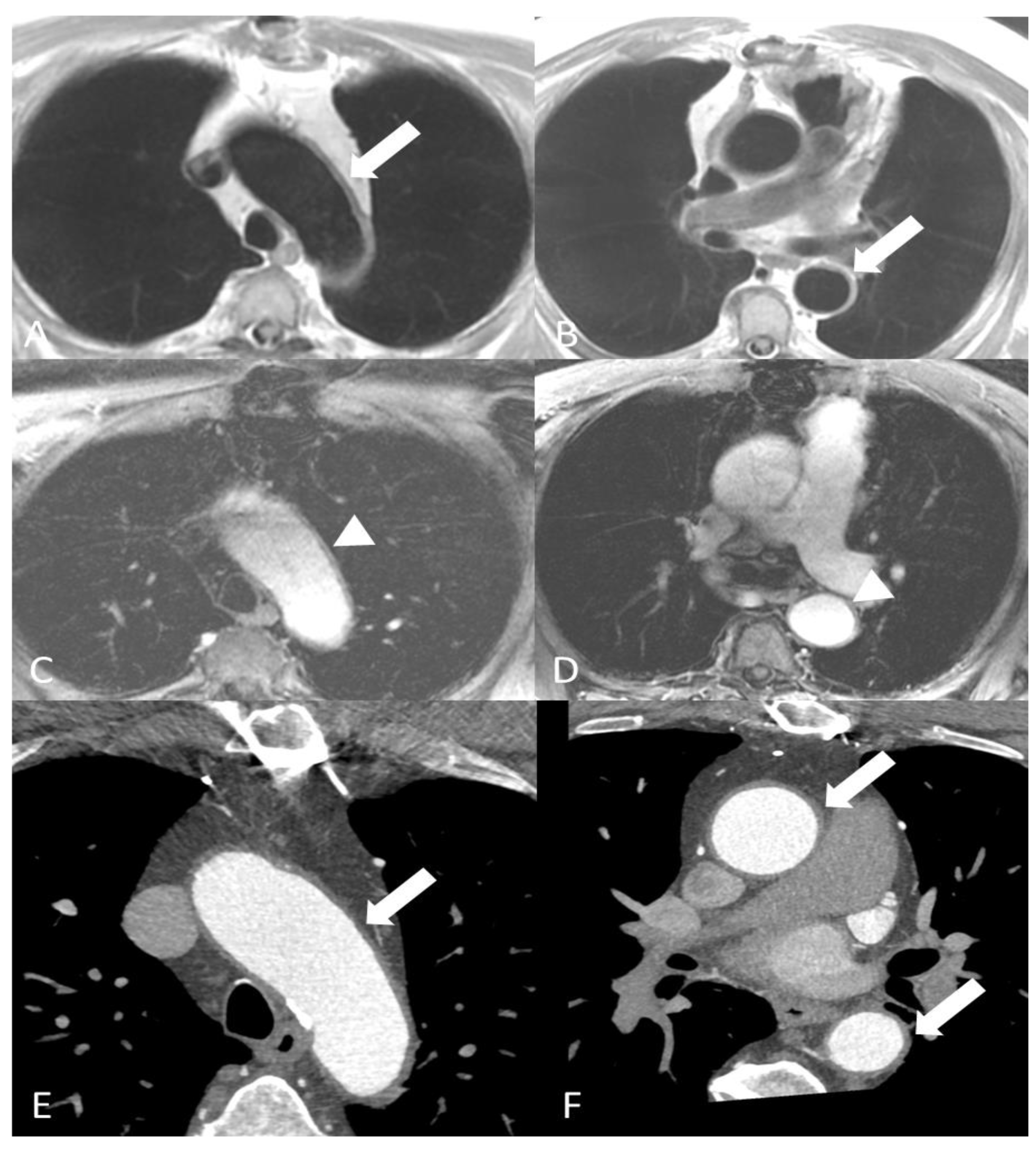 Diagnostics 14 00838 g002