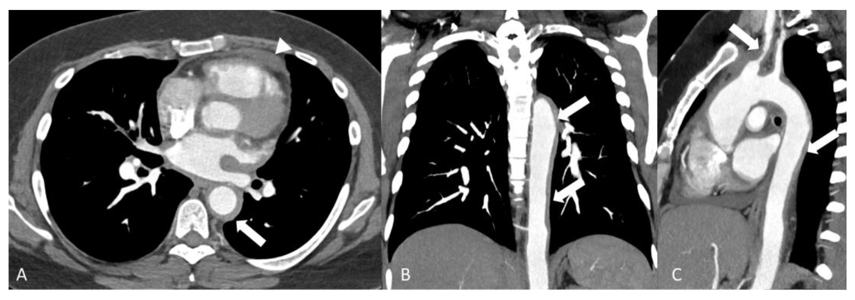 Diagnostics 14 00838 g005