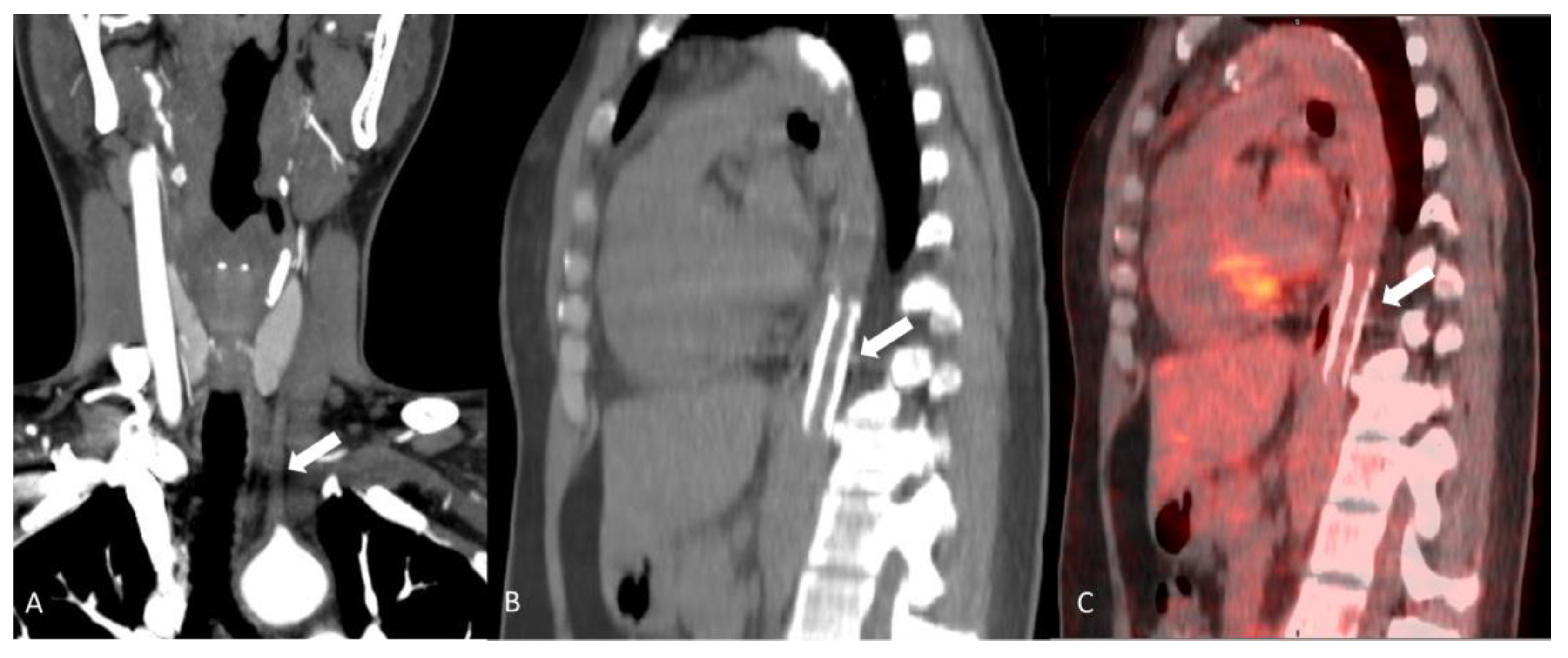 Diagnostics 14 00838 g006
