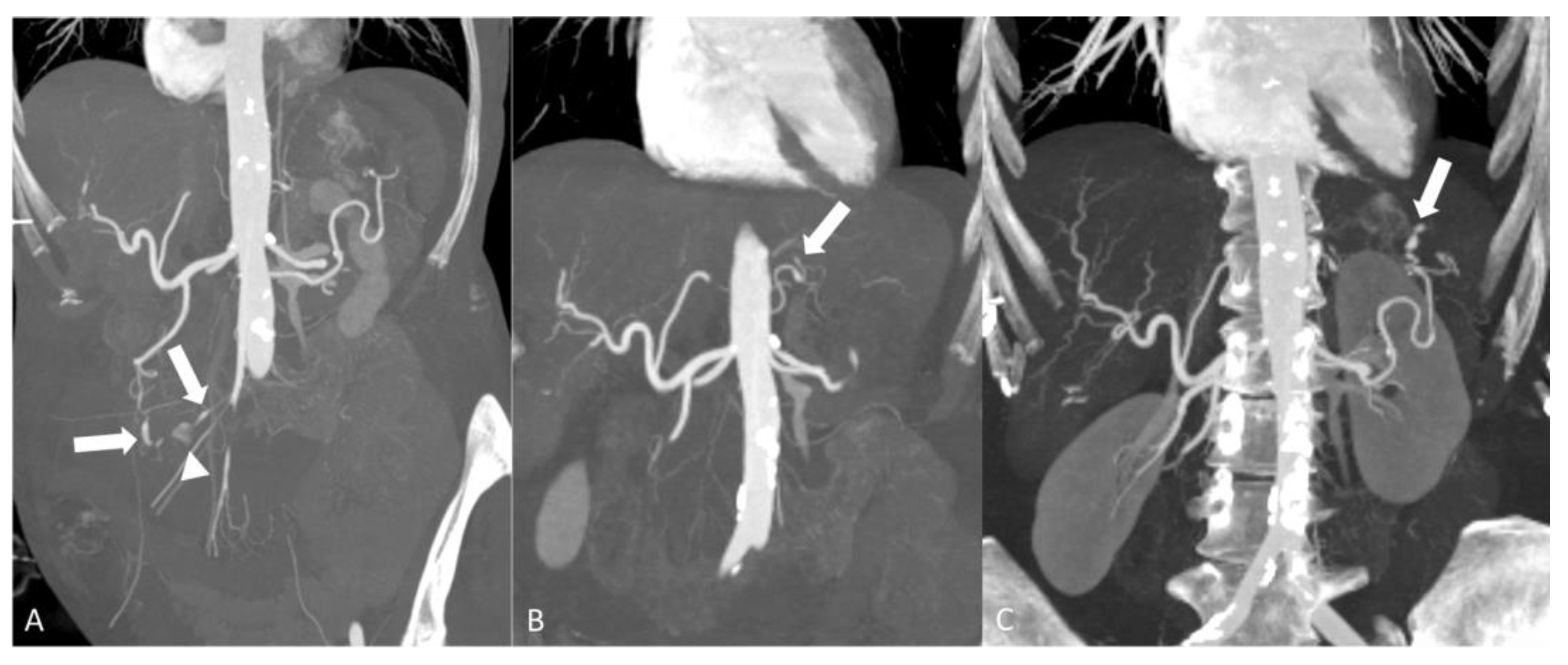 Diagnostics 14 00838 g008