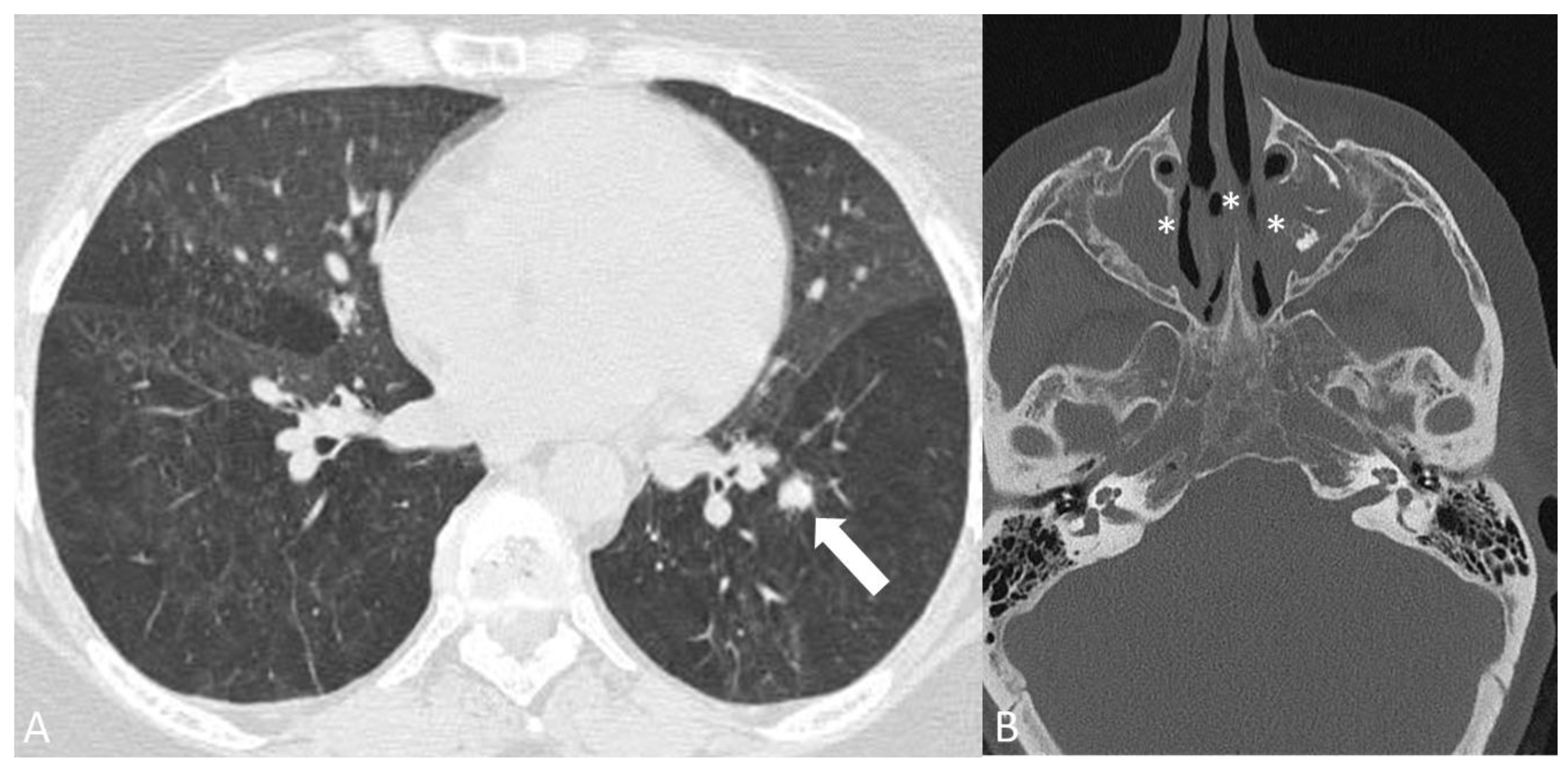 Diagnostics 14 00838 g010