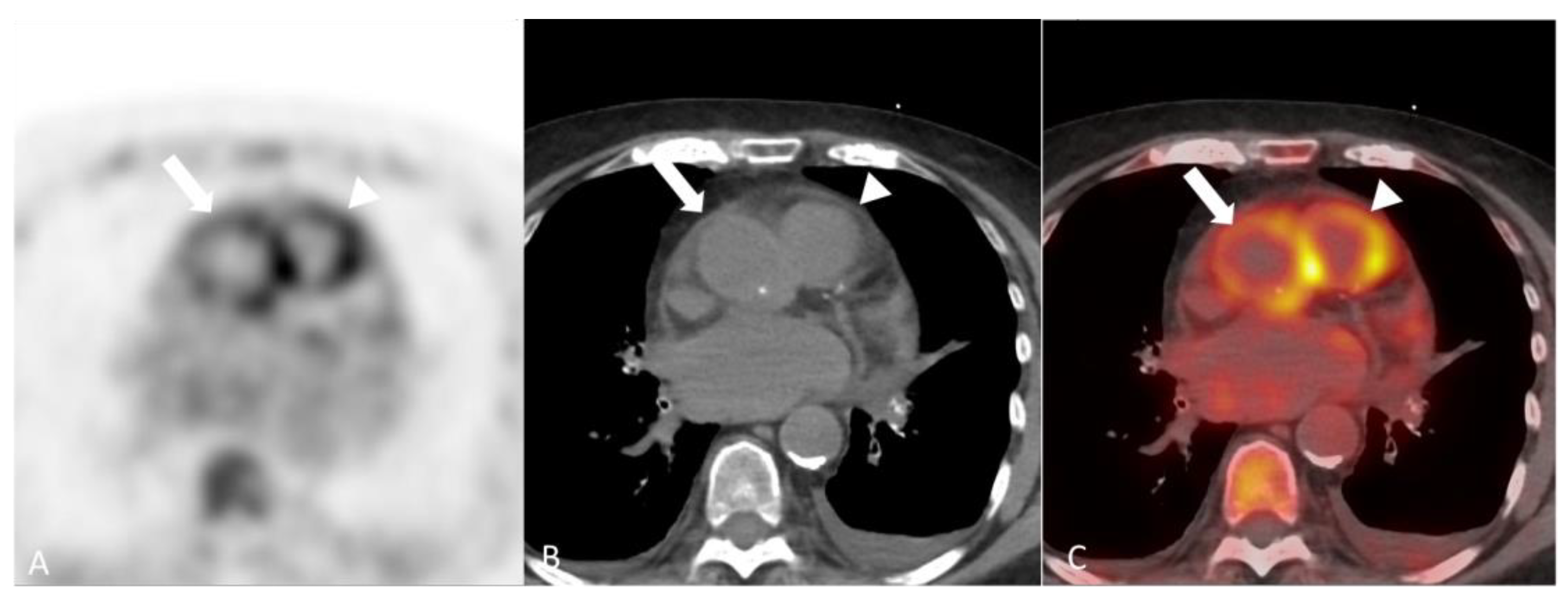 Diagnostics 14 00838 g012