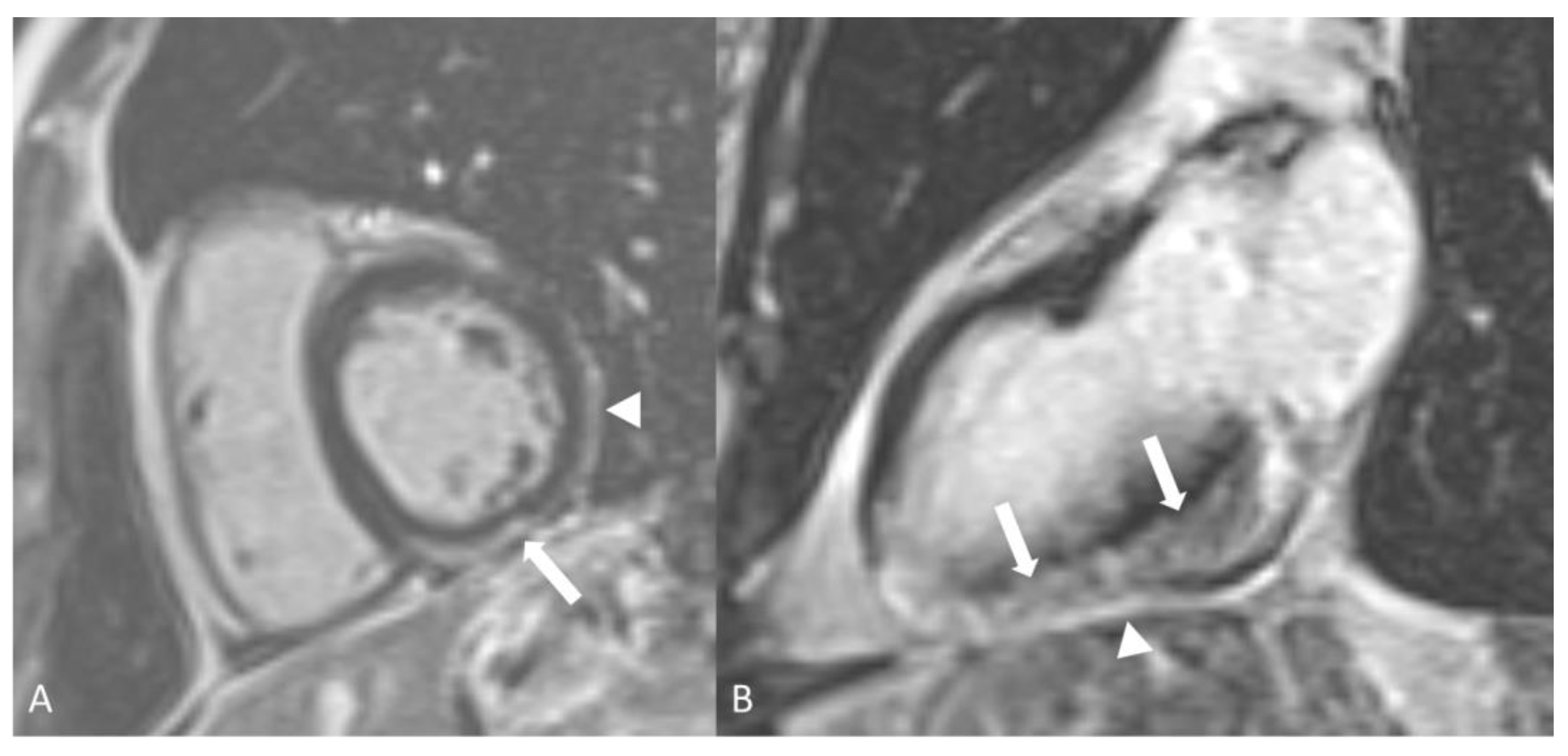 Diagnostics 14 00838 g013