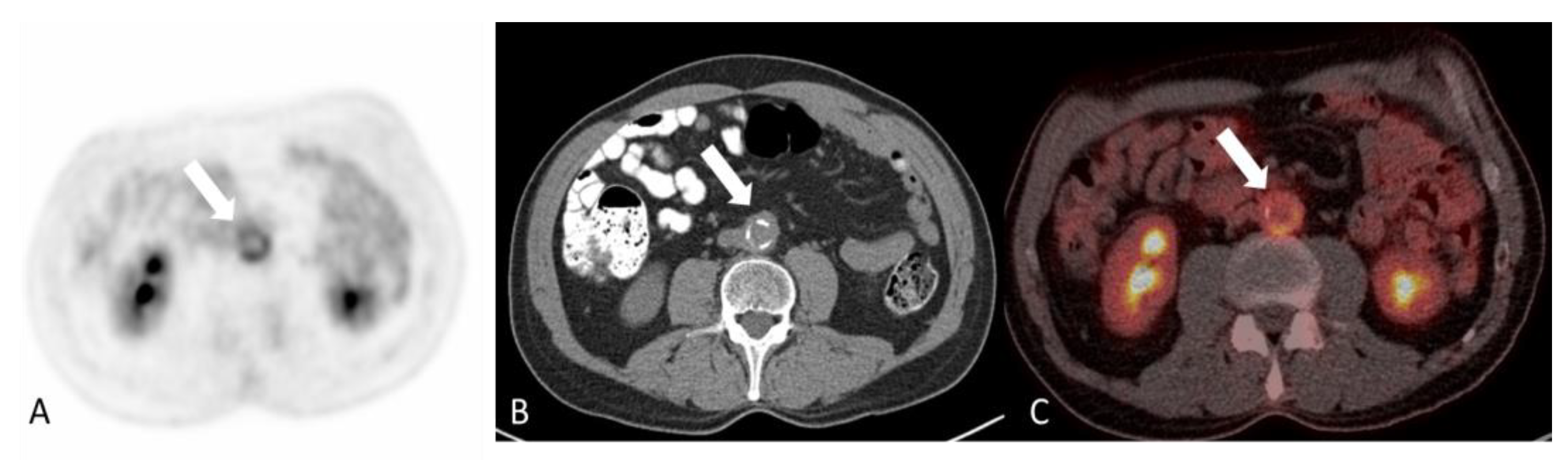 Diagnostics 14 00838 g014