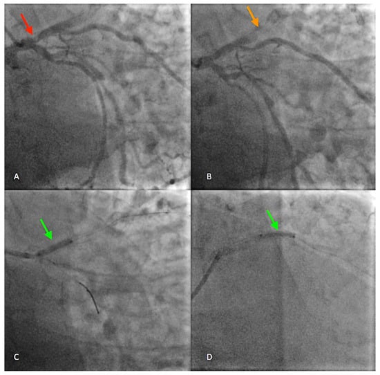 Diagnostics 14 00840 g001