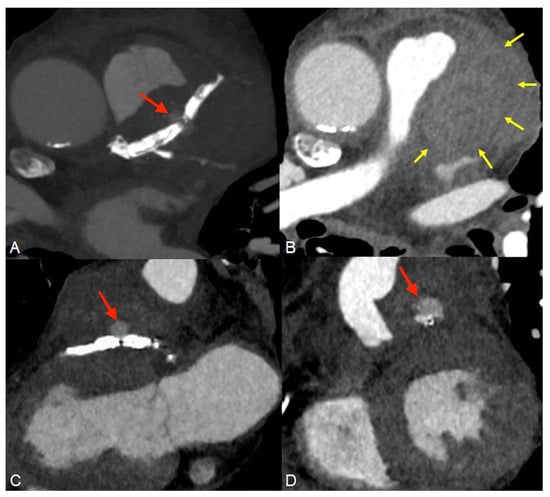 Diagnostics 14 00840 g002